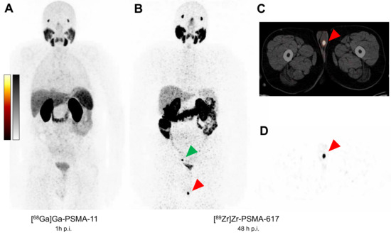 Diagnostics 13 01352 g001 550
