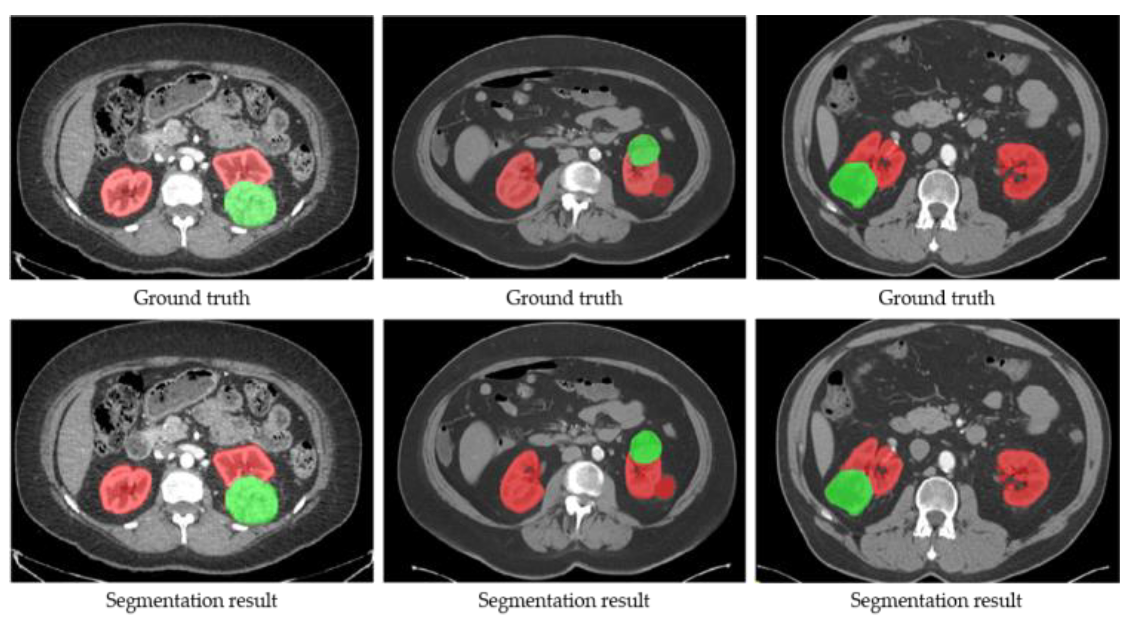 Diagnostics 13 01358 g004
