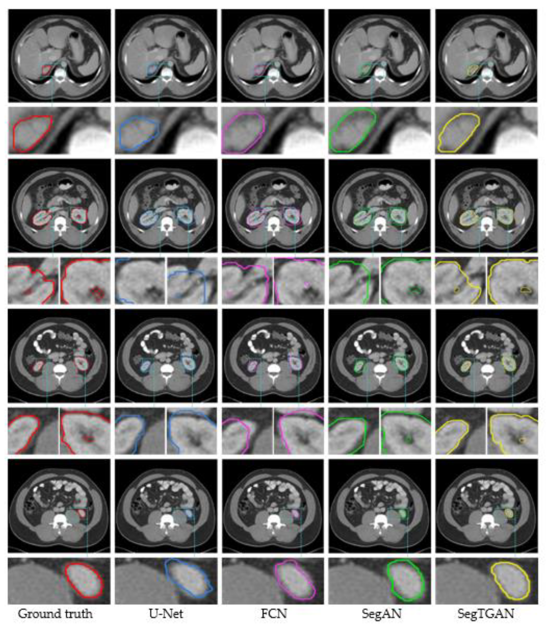Diagnostics 13 01358 g005