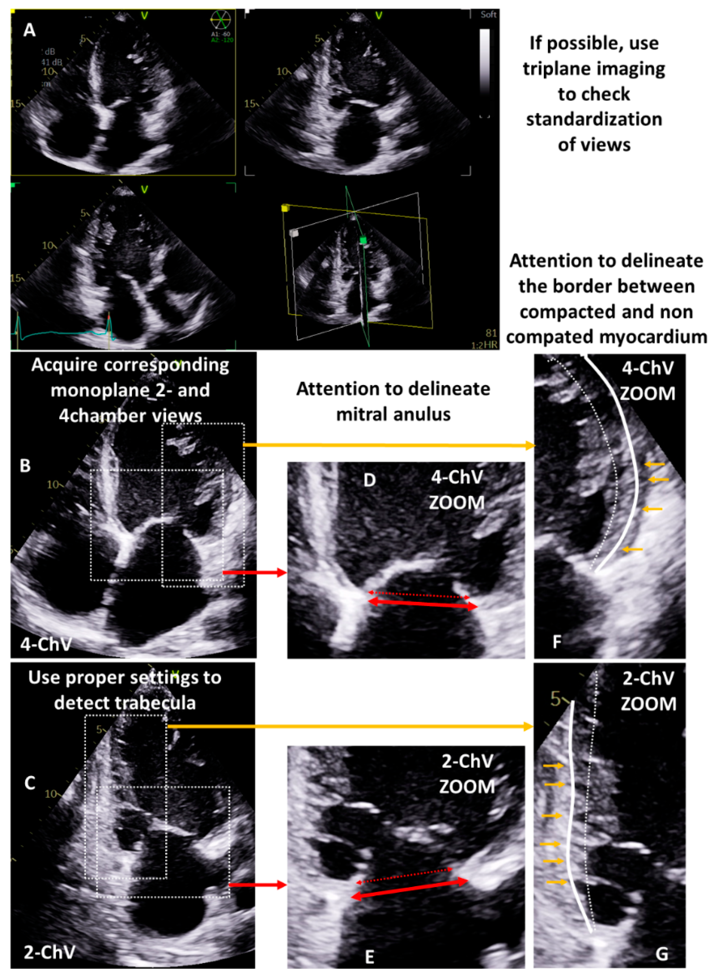 Diagnostics 13 01359 g001