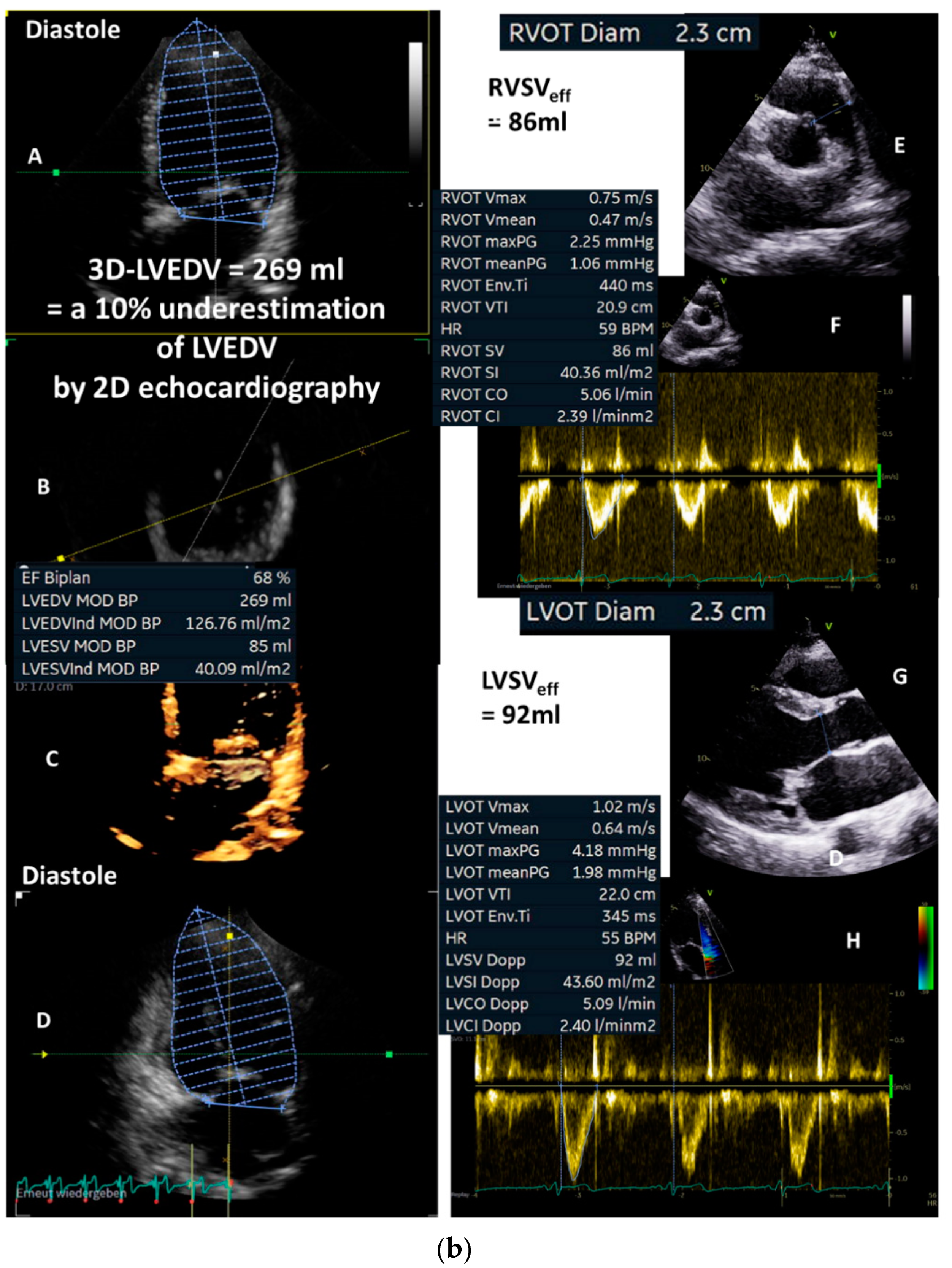 Diagnostics 13 01359 g003b