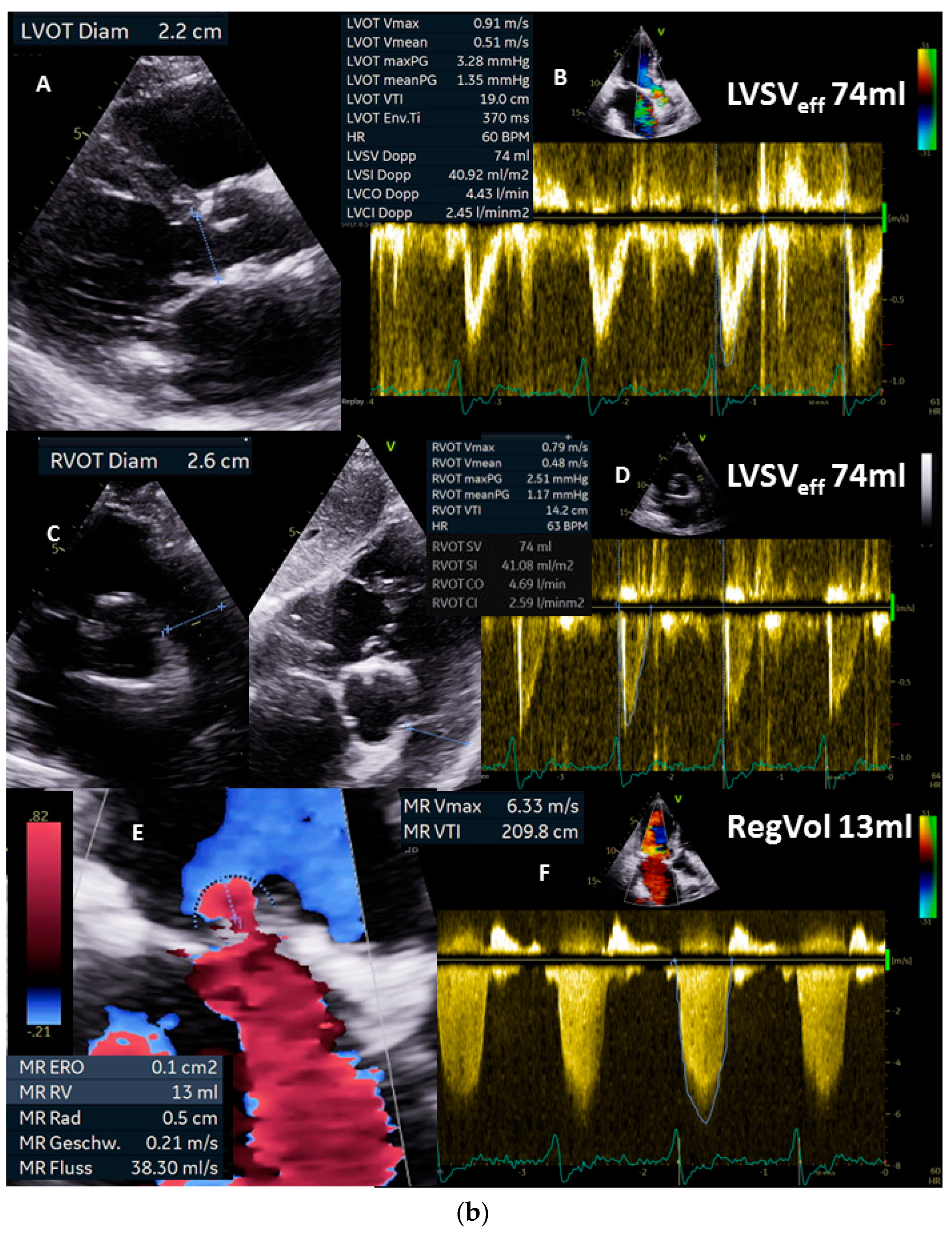 Diagnostics 13 01359 g004b