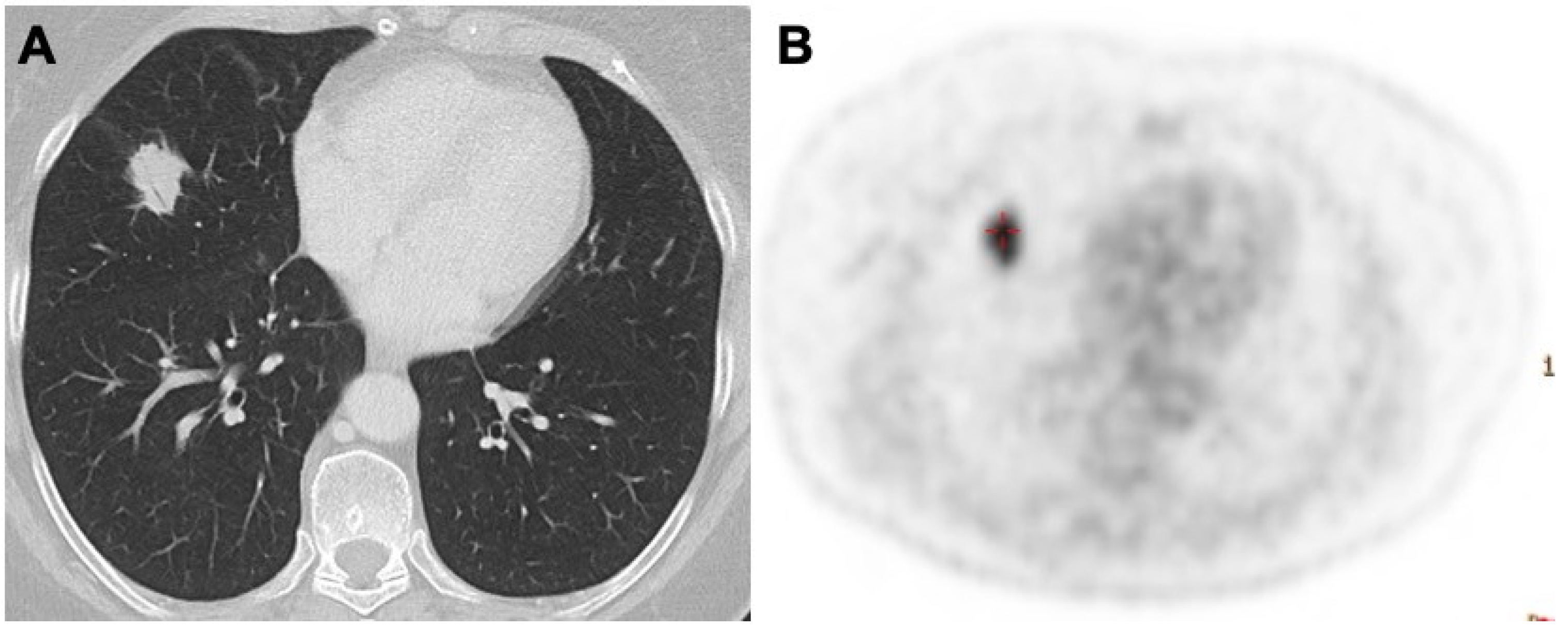 Diagnostics 13 01360 g002