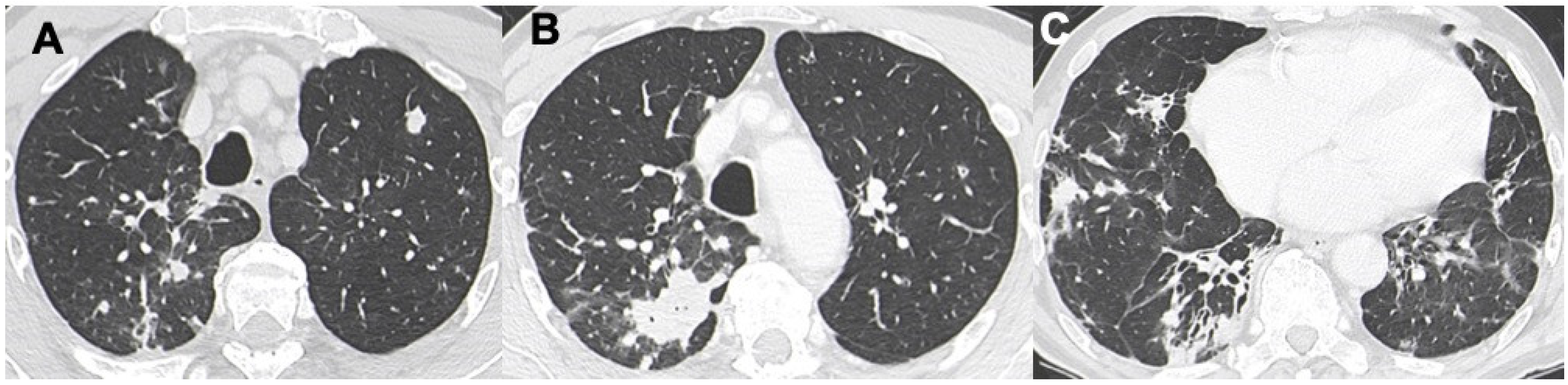 Diagnostics 13 01360 g004