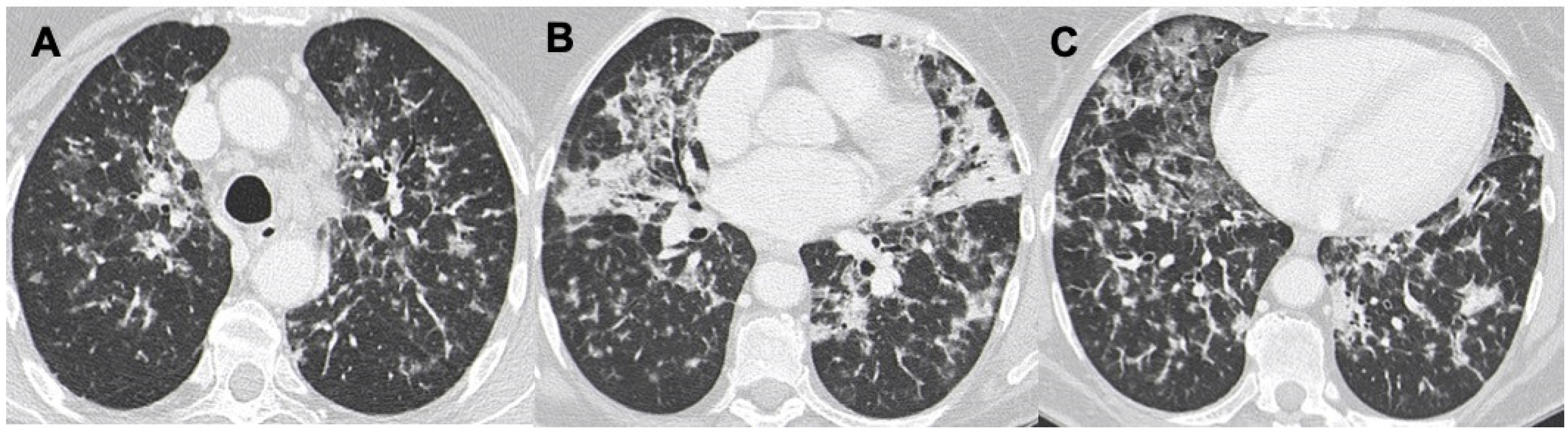 Diagnostics 13 01360 g005