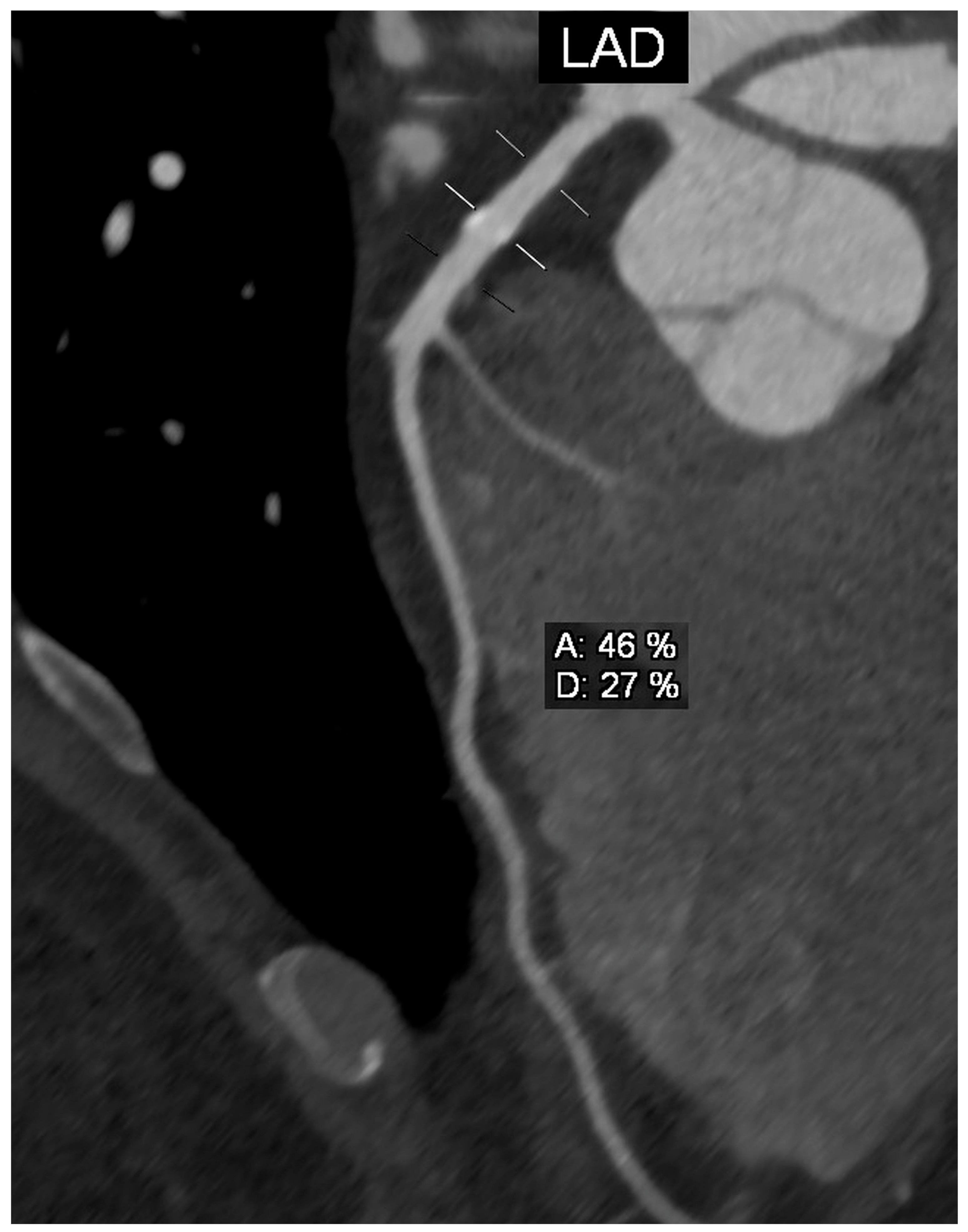 Diagnostics 13 01369 g003