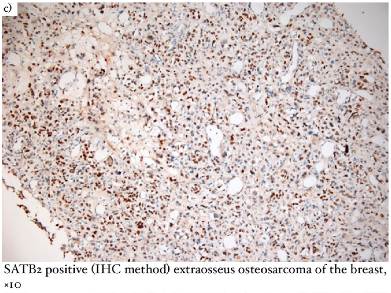 Diagnostics 13 01370 g003b