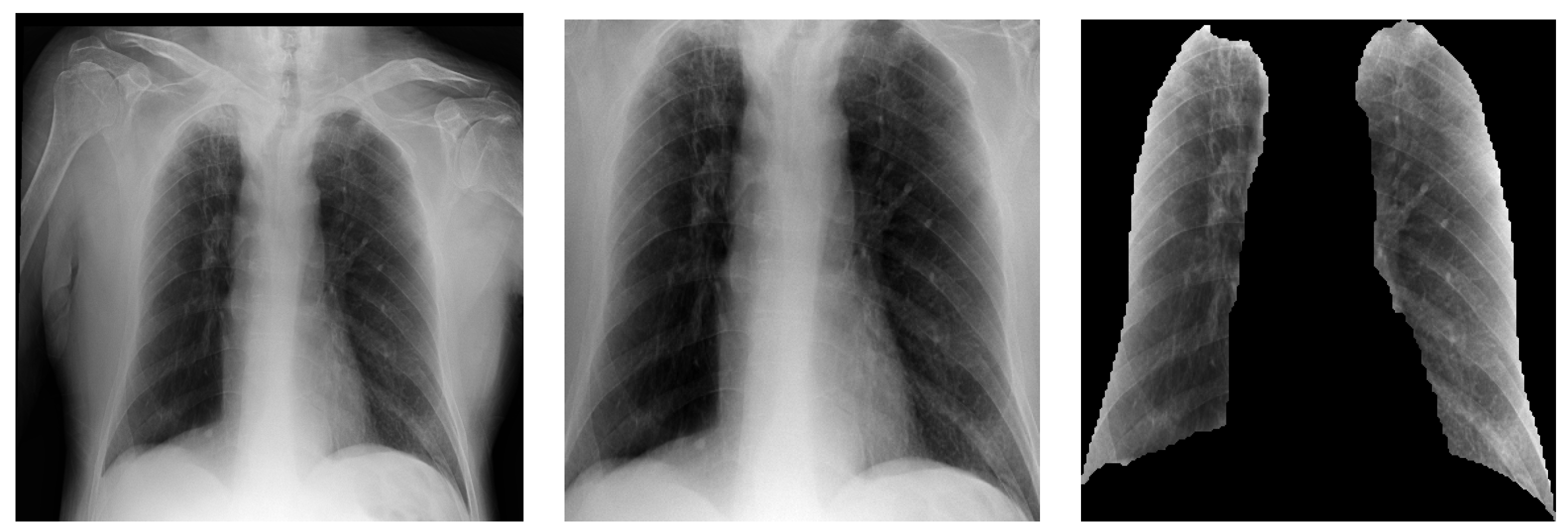Diagnostics 13 01381 g005 Diagnostics 13 01381 g005