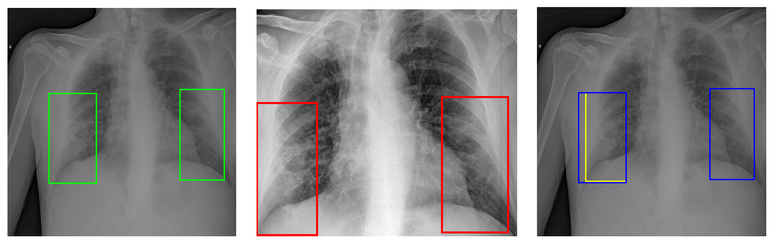 Diagnostics 13 01381 g007 Diagnostics 13 01381 g007