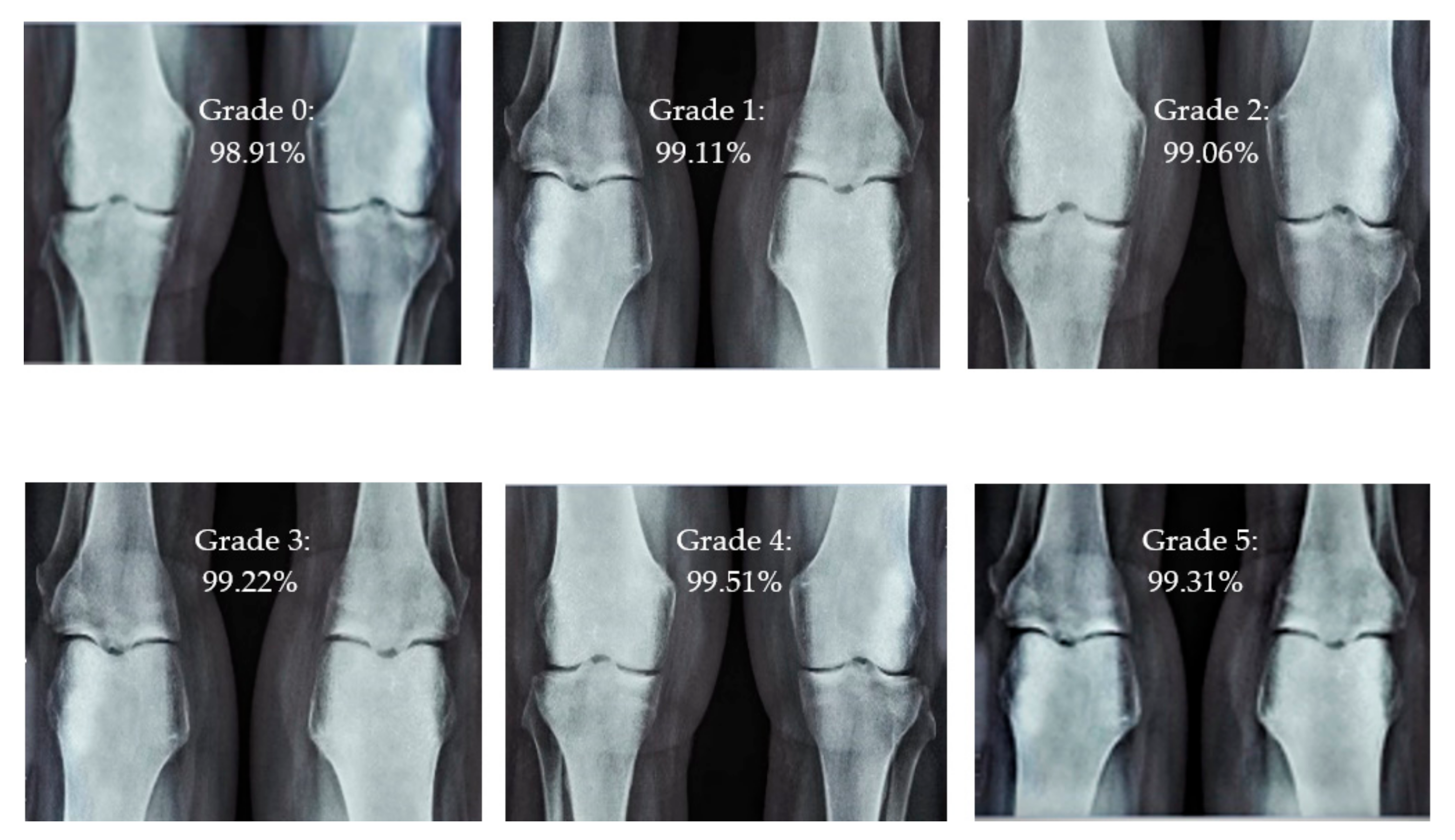 Diagnostics 13 01385 g005