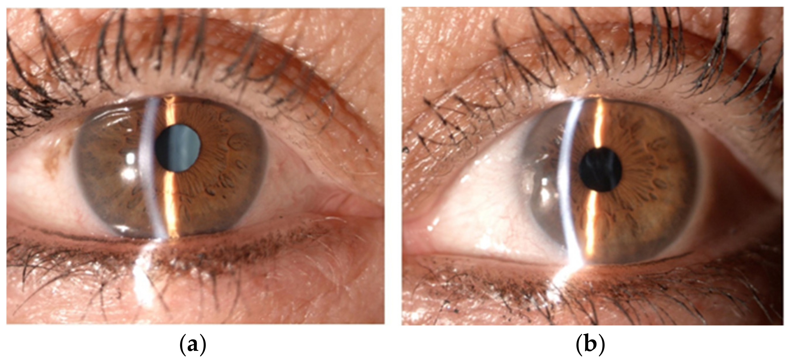 Diagnostics 13 01400 g001