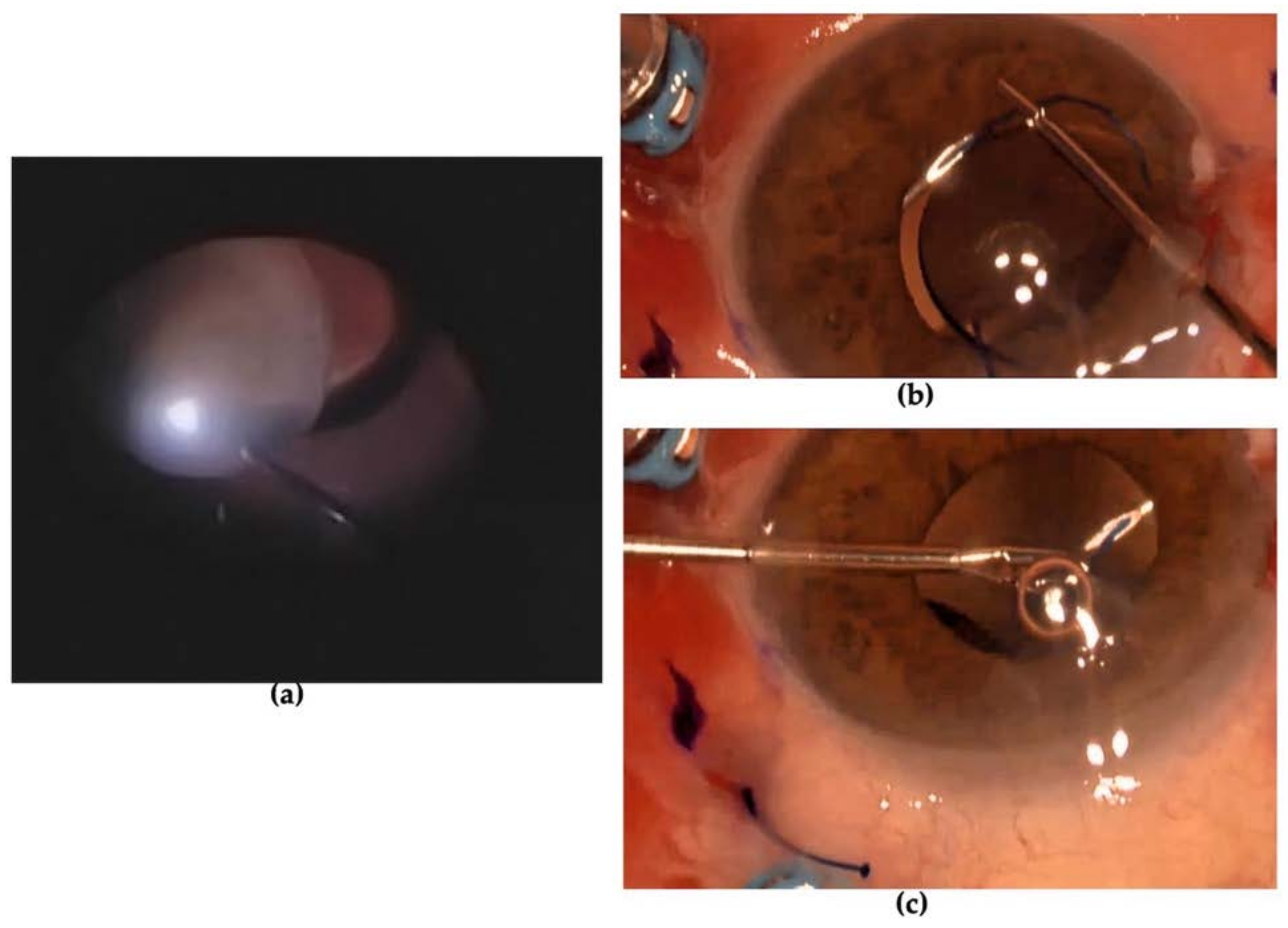 Diagnostics 13 01400 g005