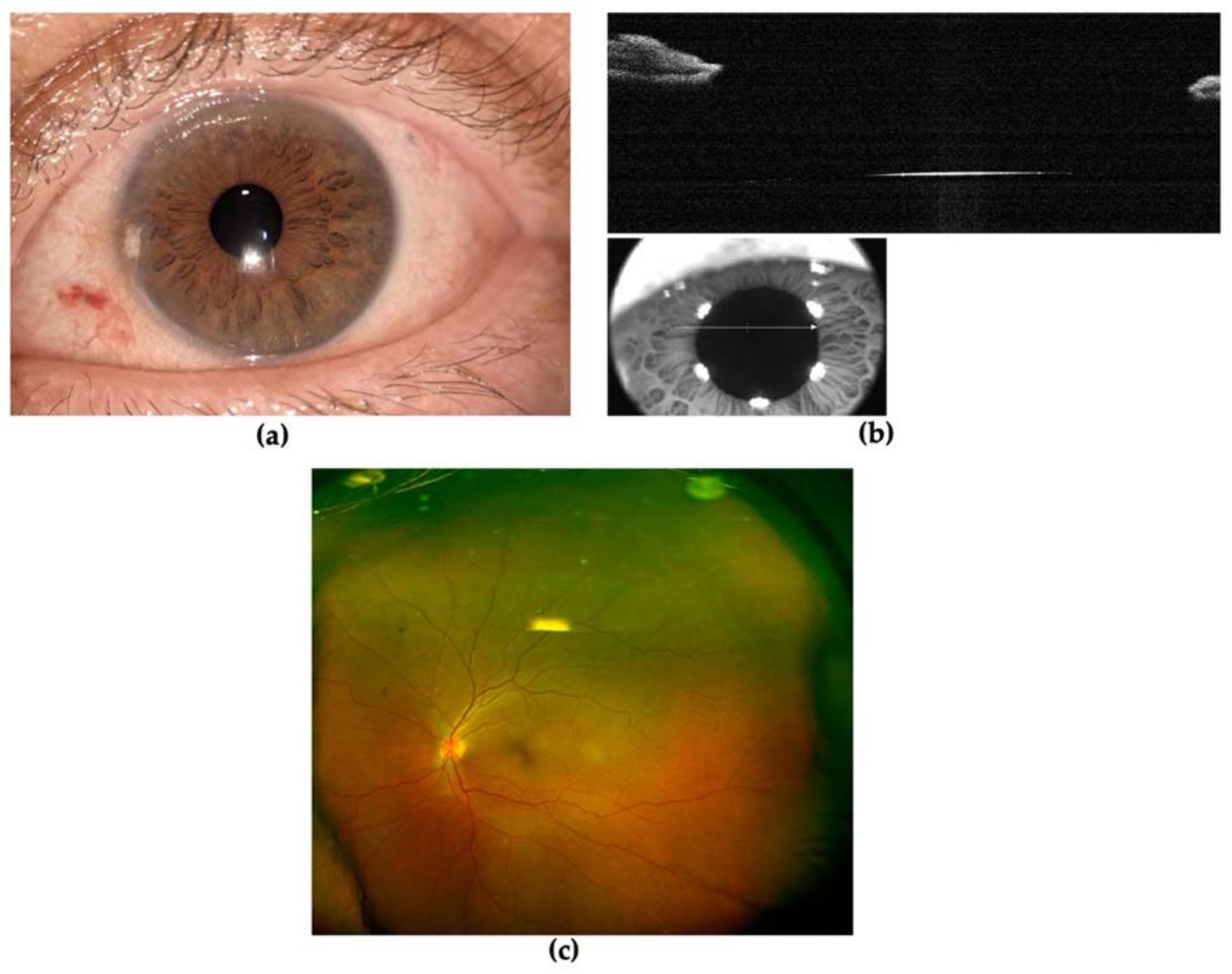 Diagnostics 13 01400 g006