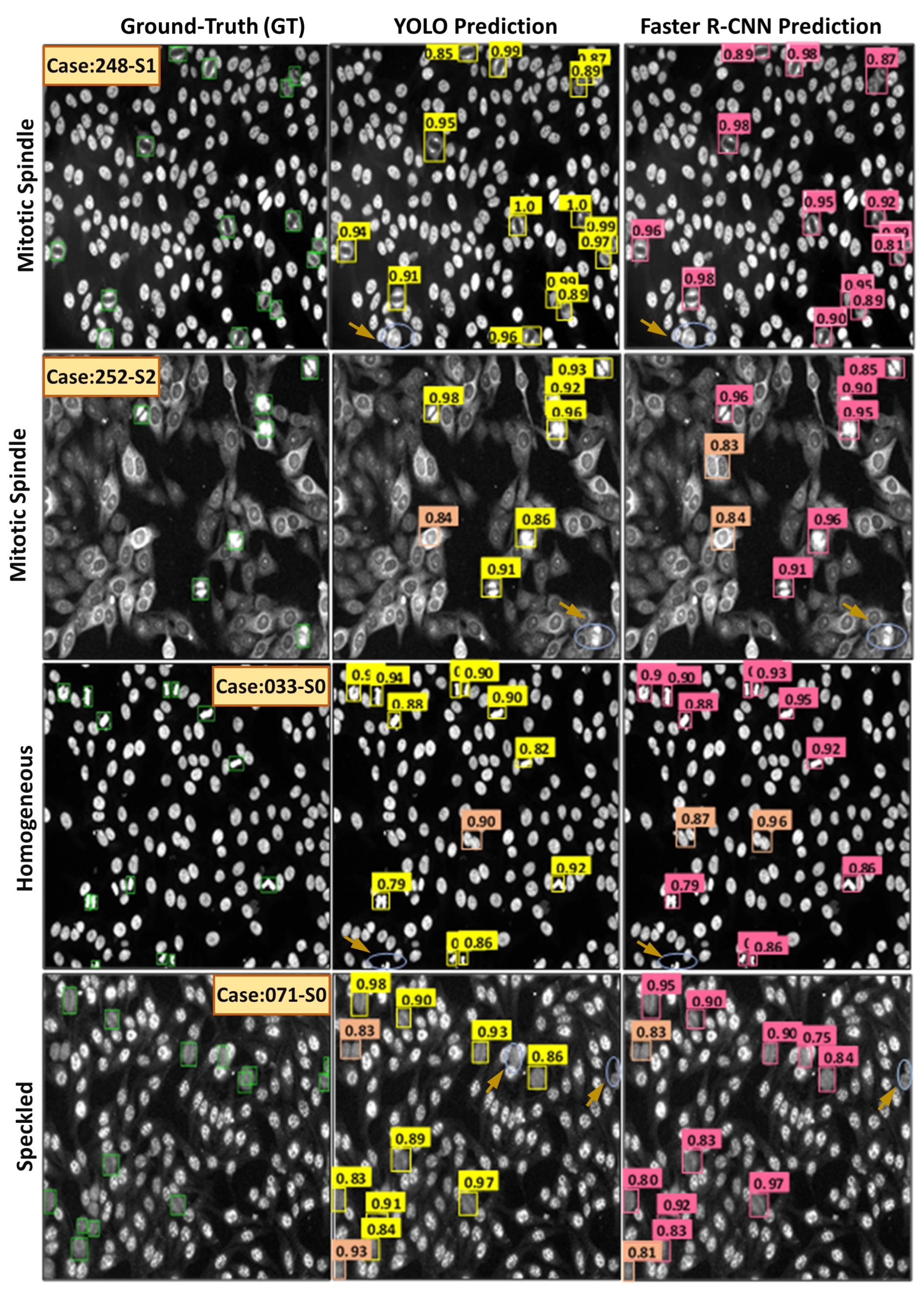 Diagnostics 13 01416 g018