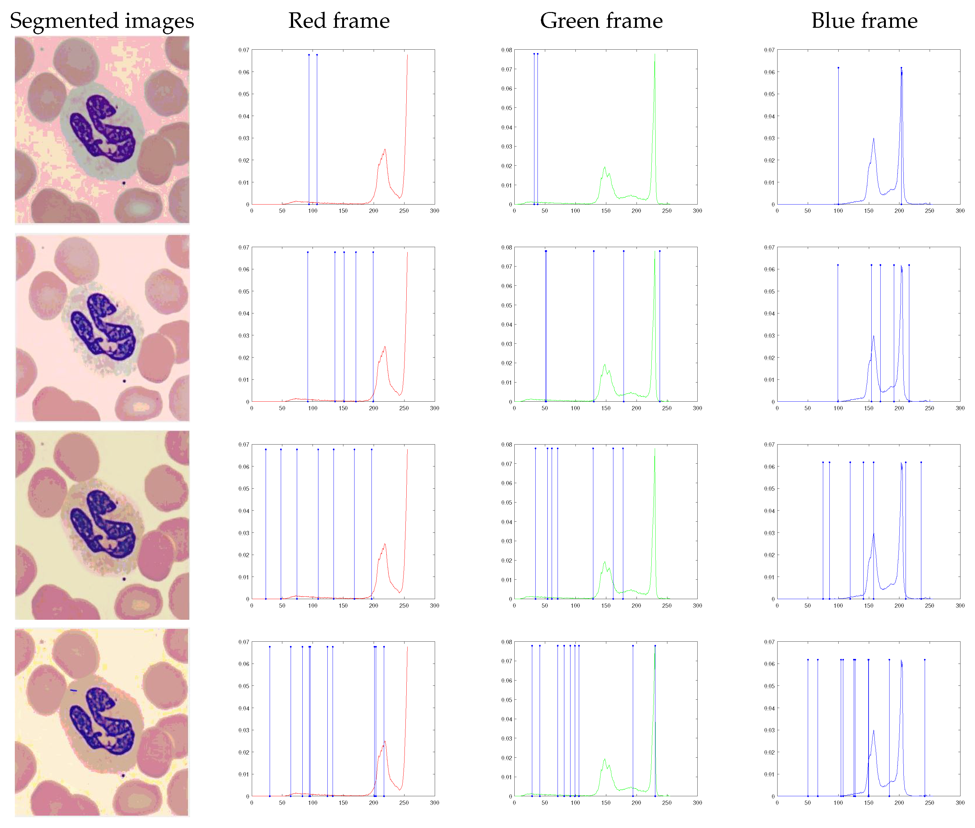 Diagnostics 13 01422 g008