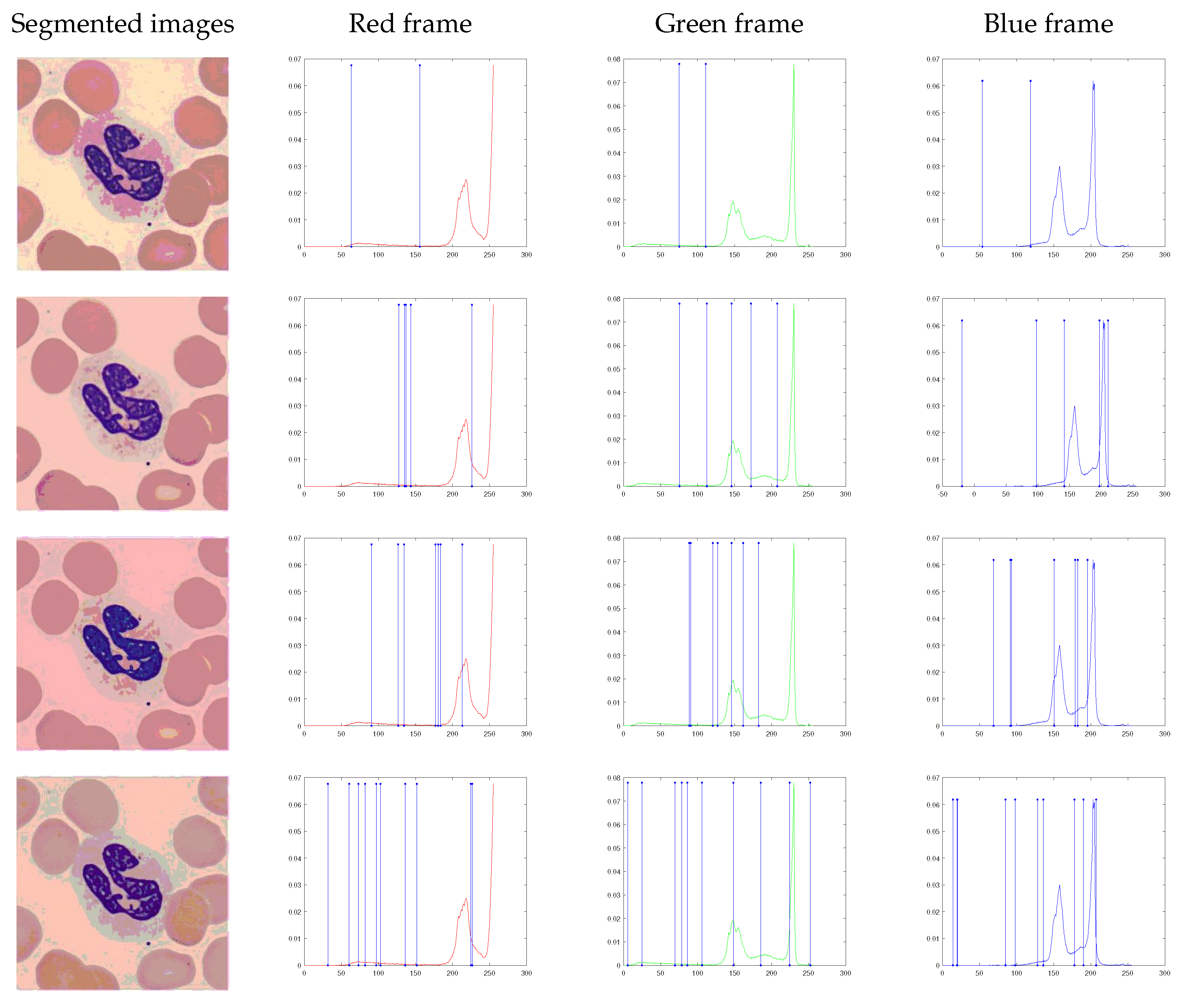 Diagnostics 13 01422 g009