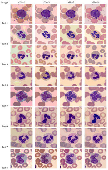Diagnostics 13 01422 g0a1