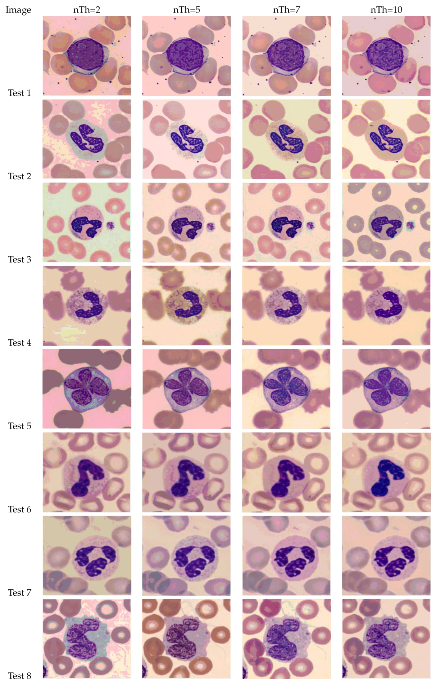 Diagnostics 13 01422 g0a1