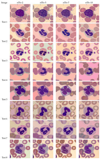 Diagnostics 13 01422 g0a2
