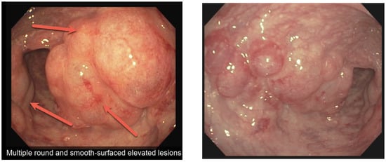 Diagnostics 13 01424 g001