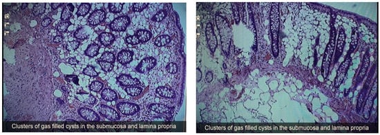 Diagnostics 13 01424 g003