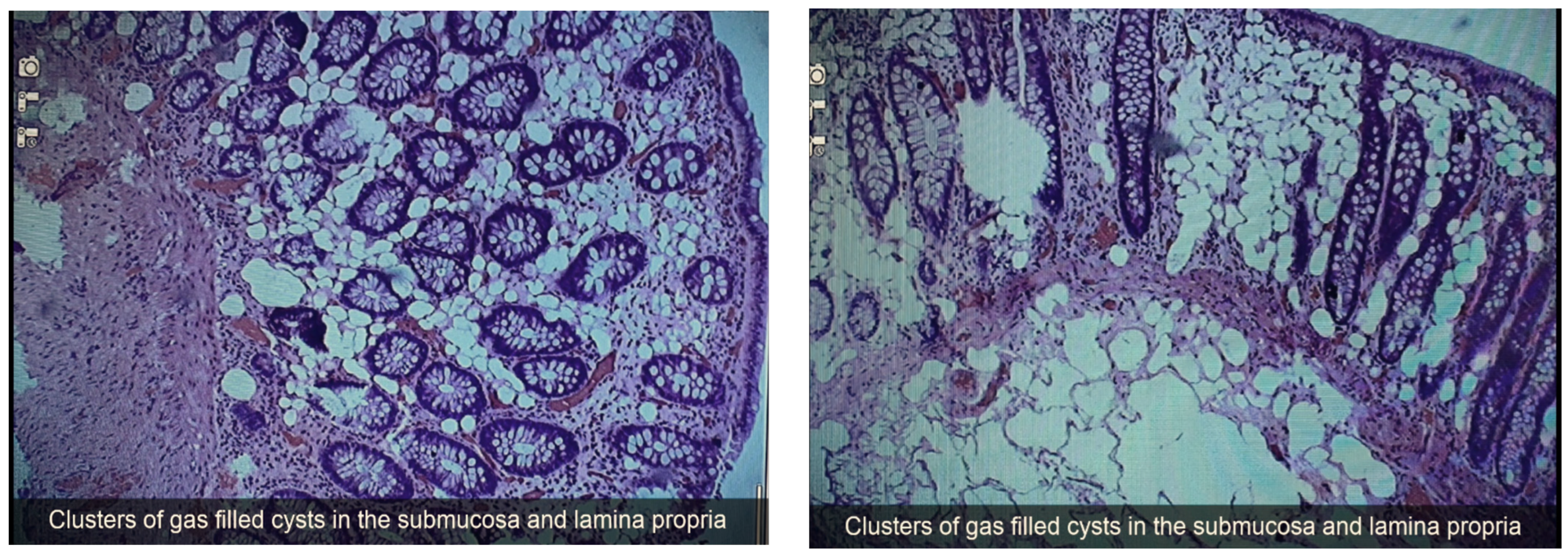 Diagnostics 13 01424 g003