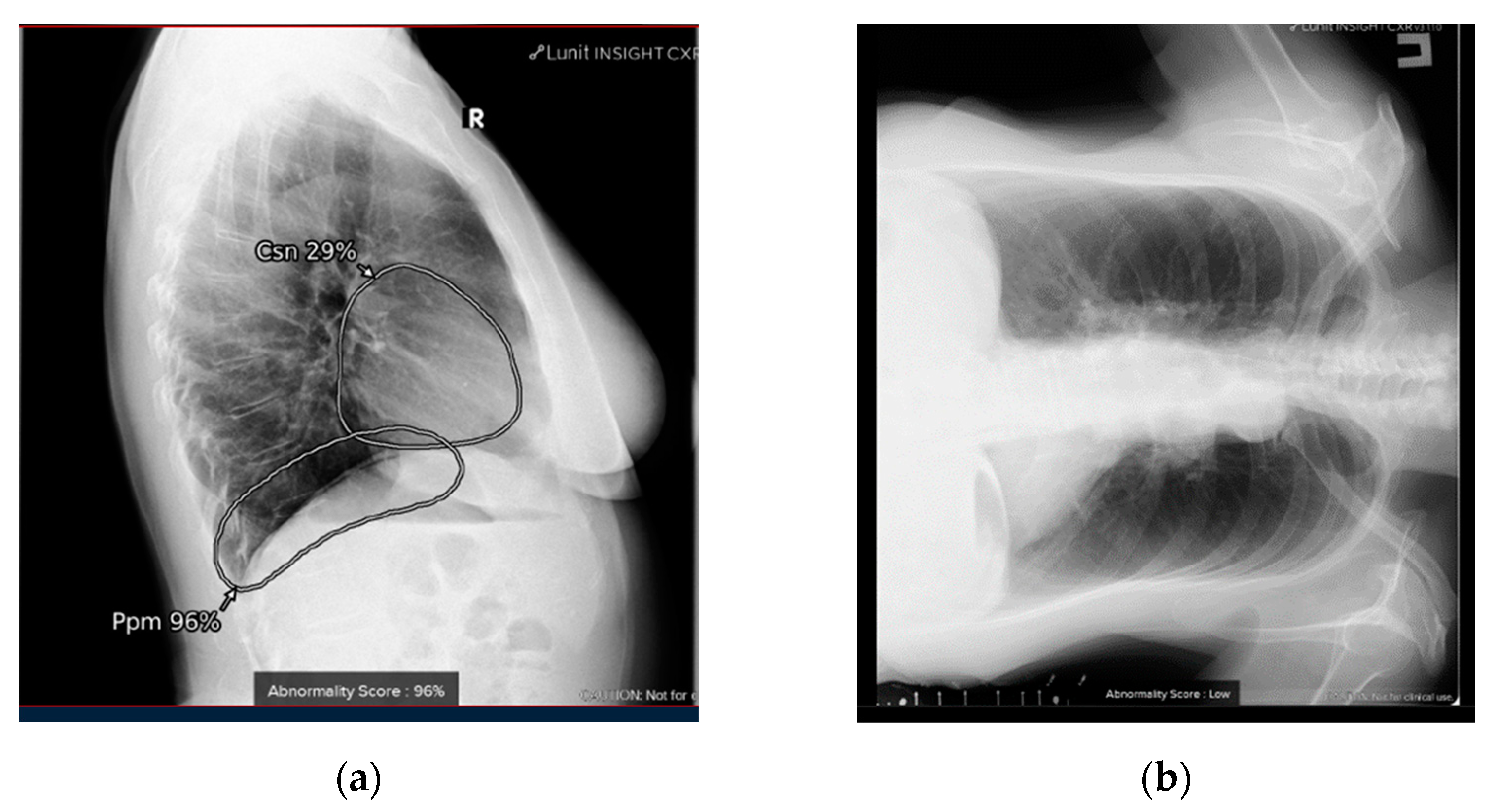 Diagnostics 13 01430 g002