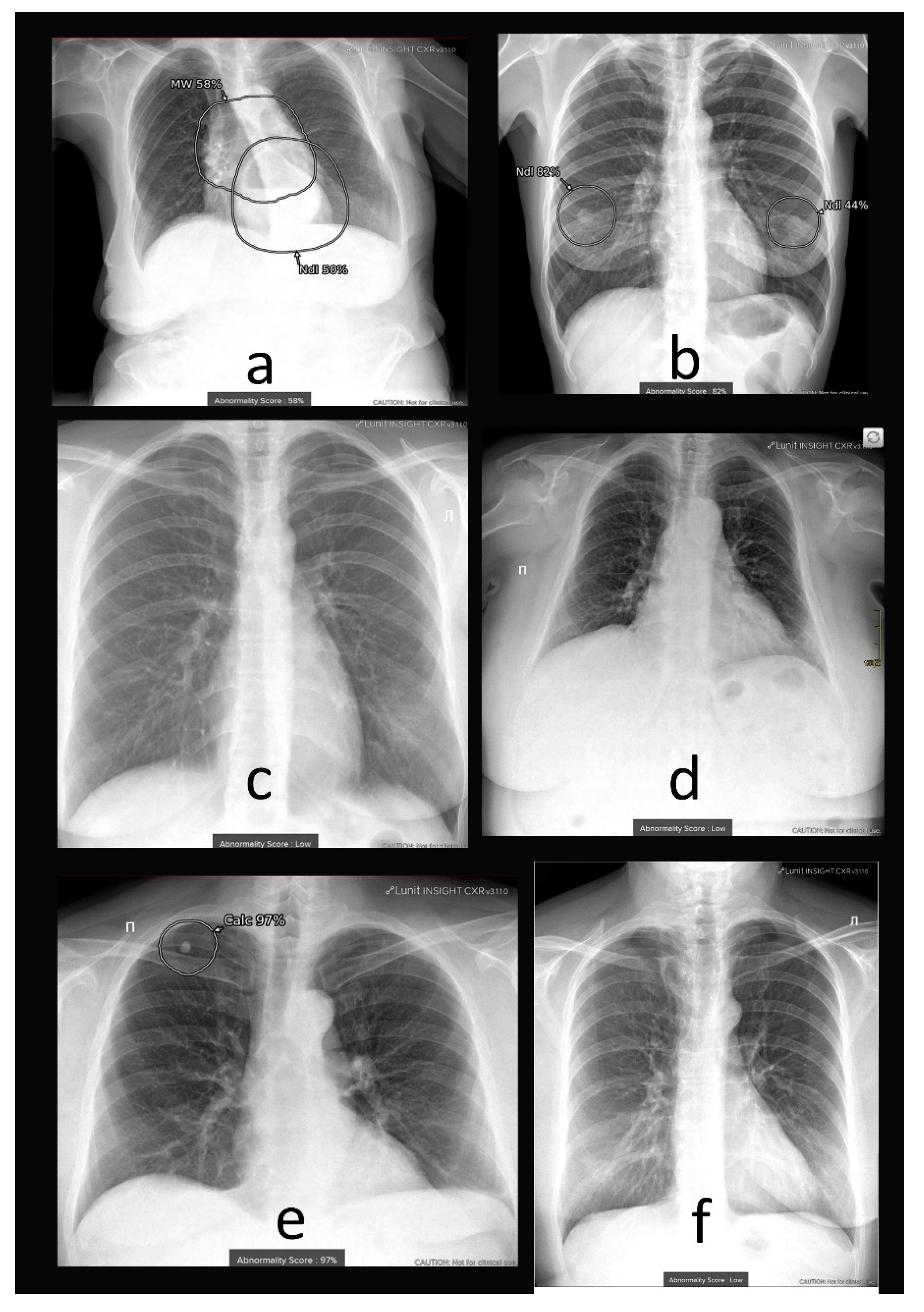 Diagnostics 13 01430 g004