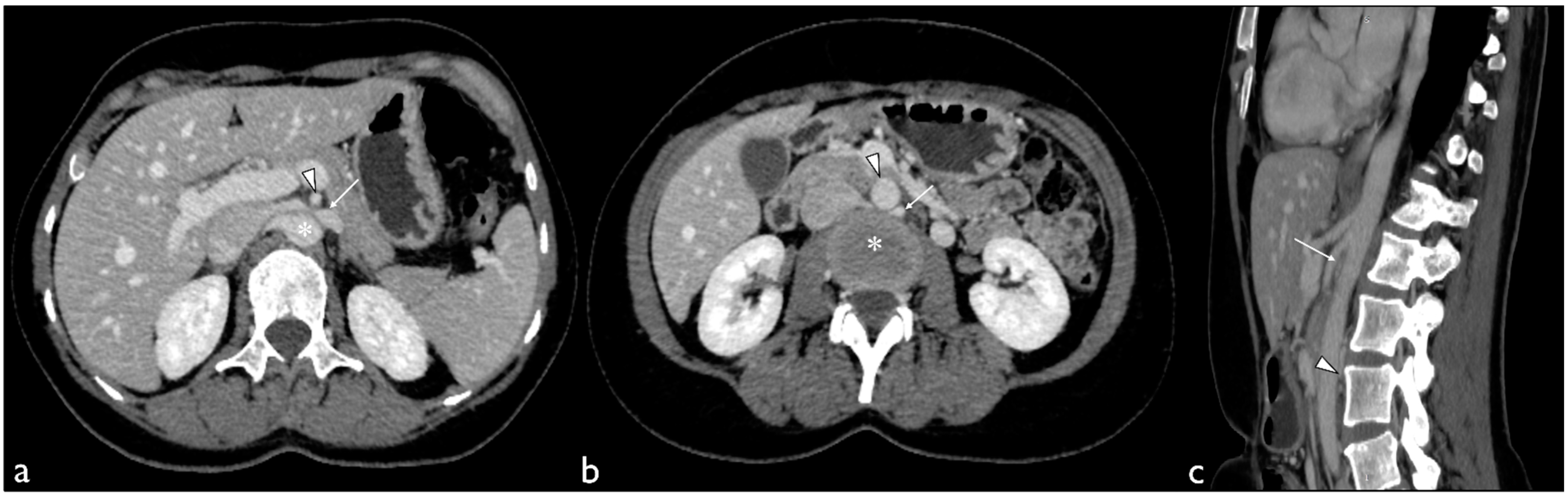 Diagnostics 13 01433 g001