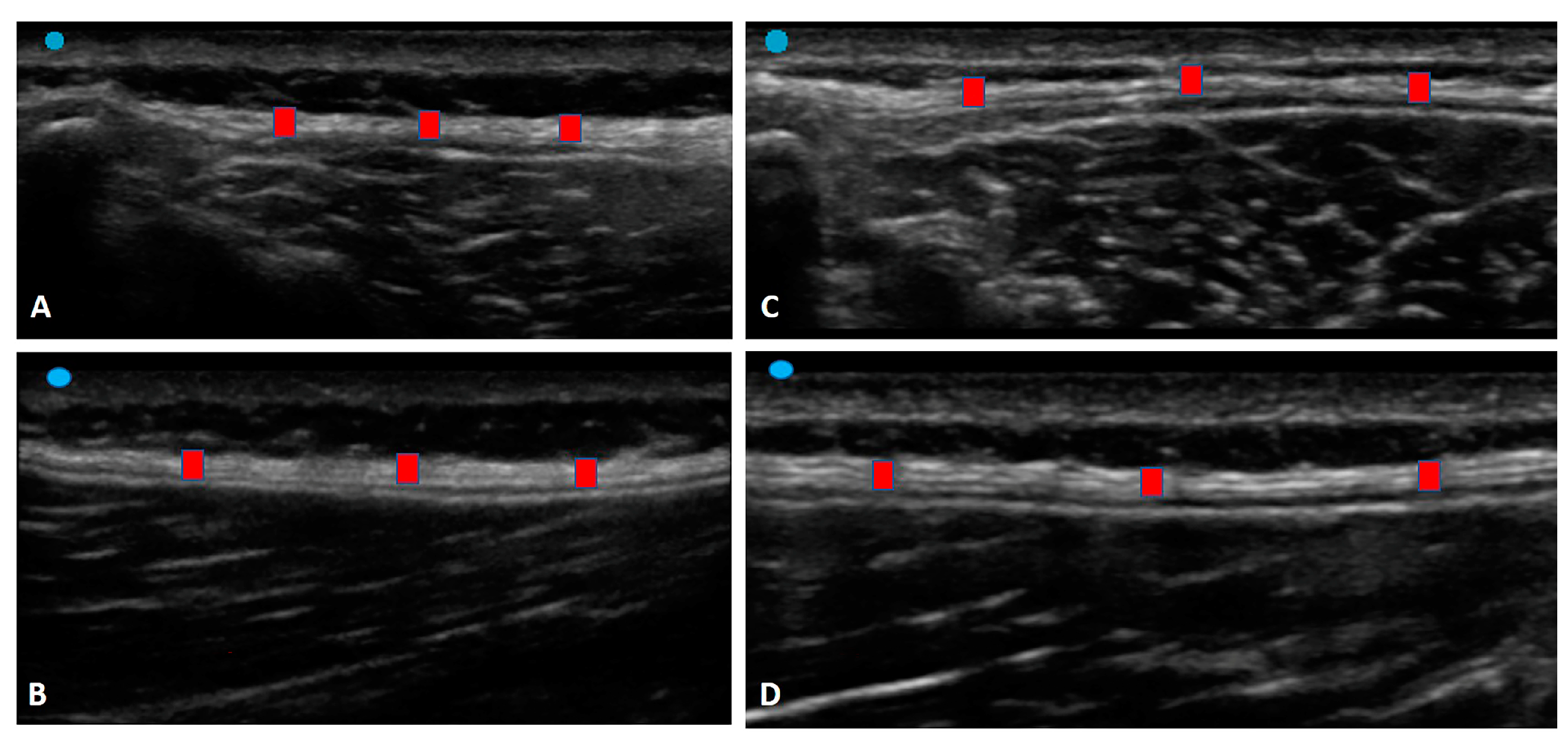 Diagnostics 13 01436 g004