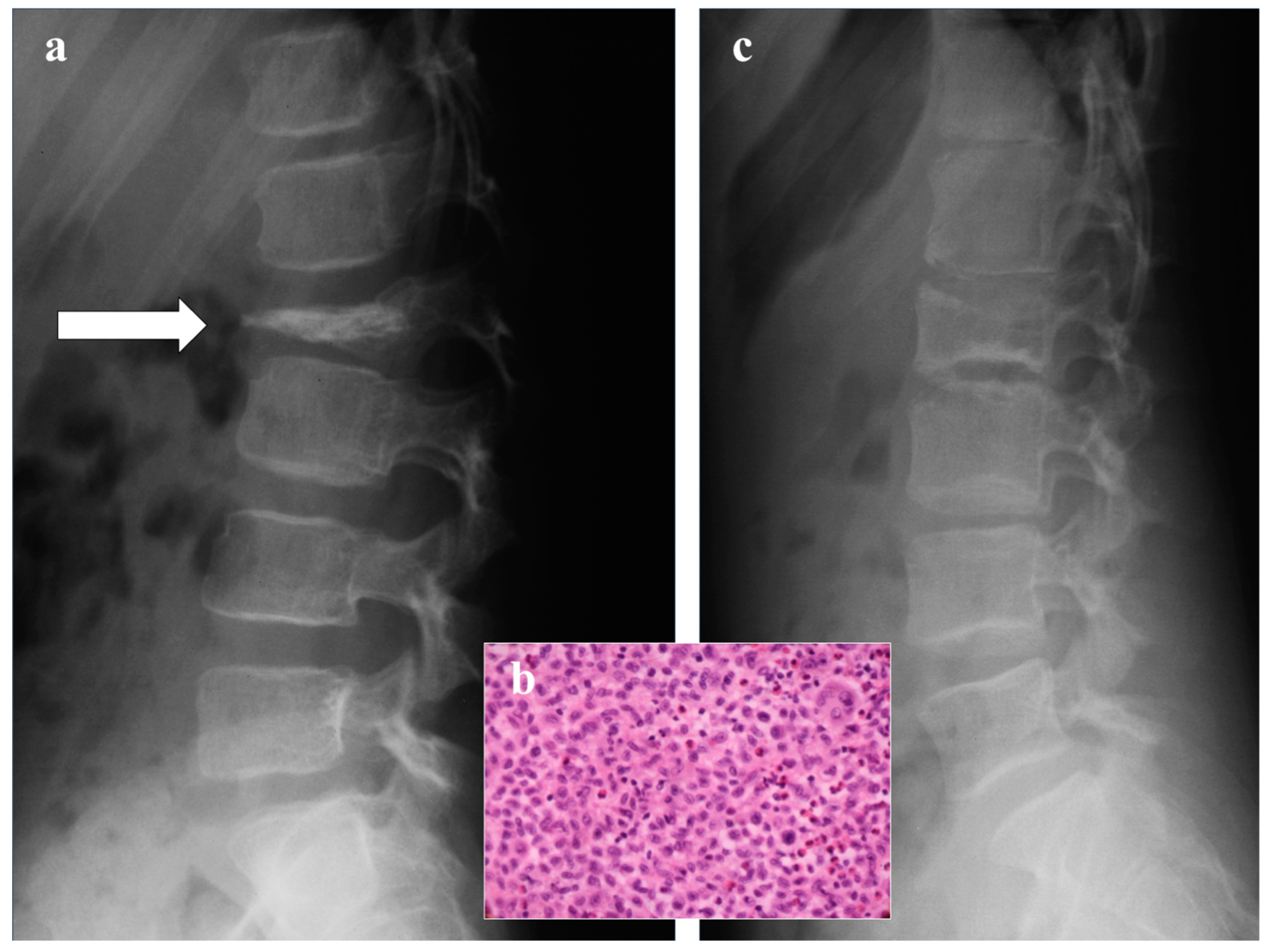 Diagnostics 13 01438 g004