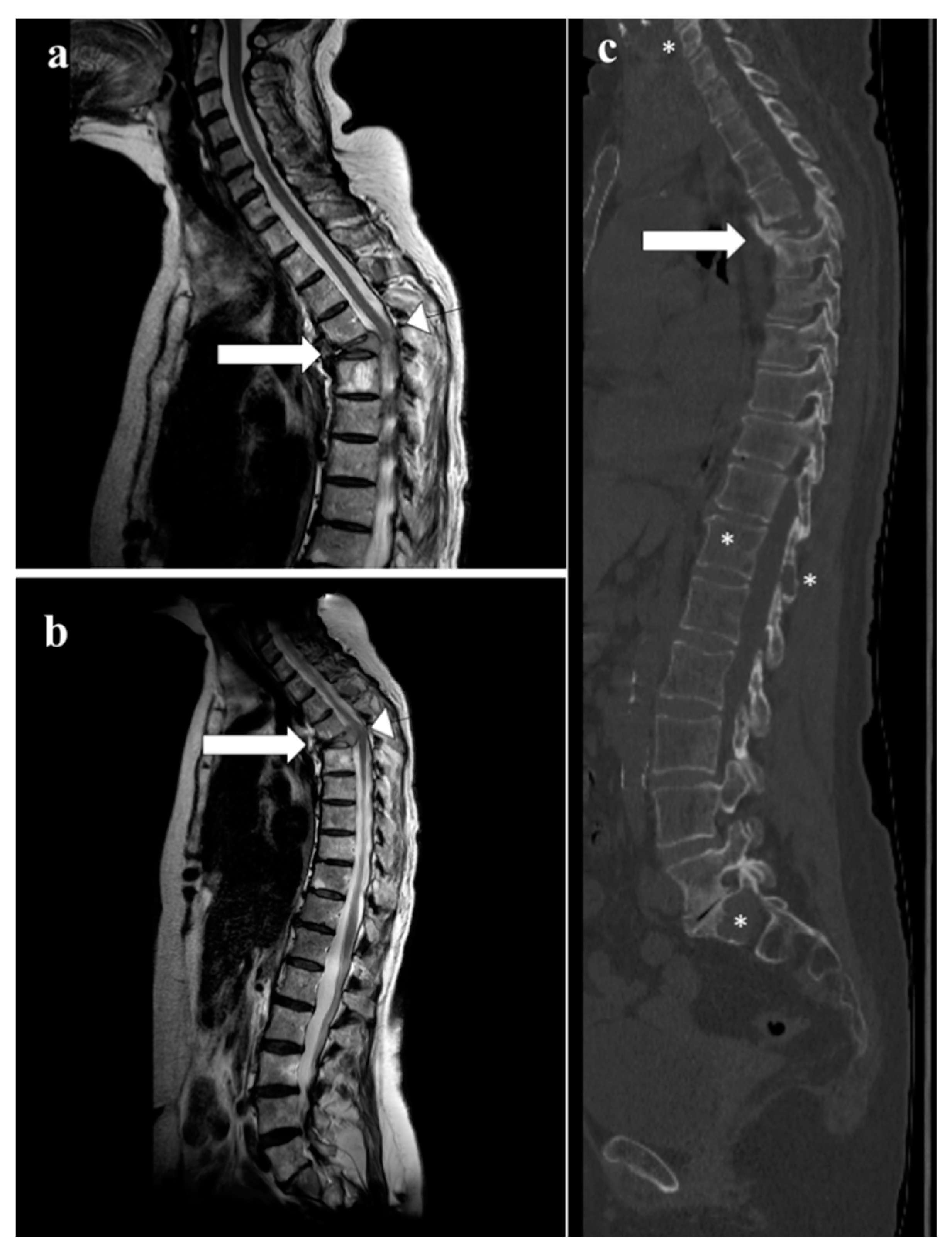 Diagnostics 13 01438 g005