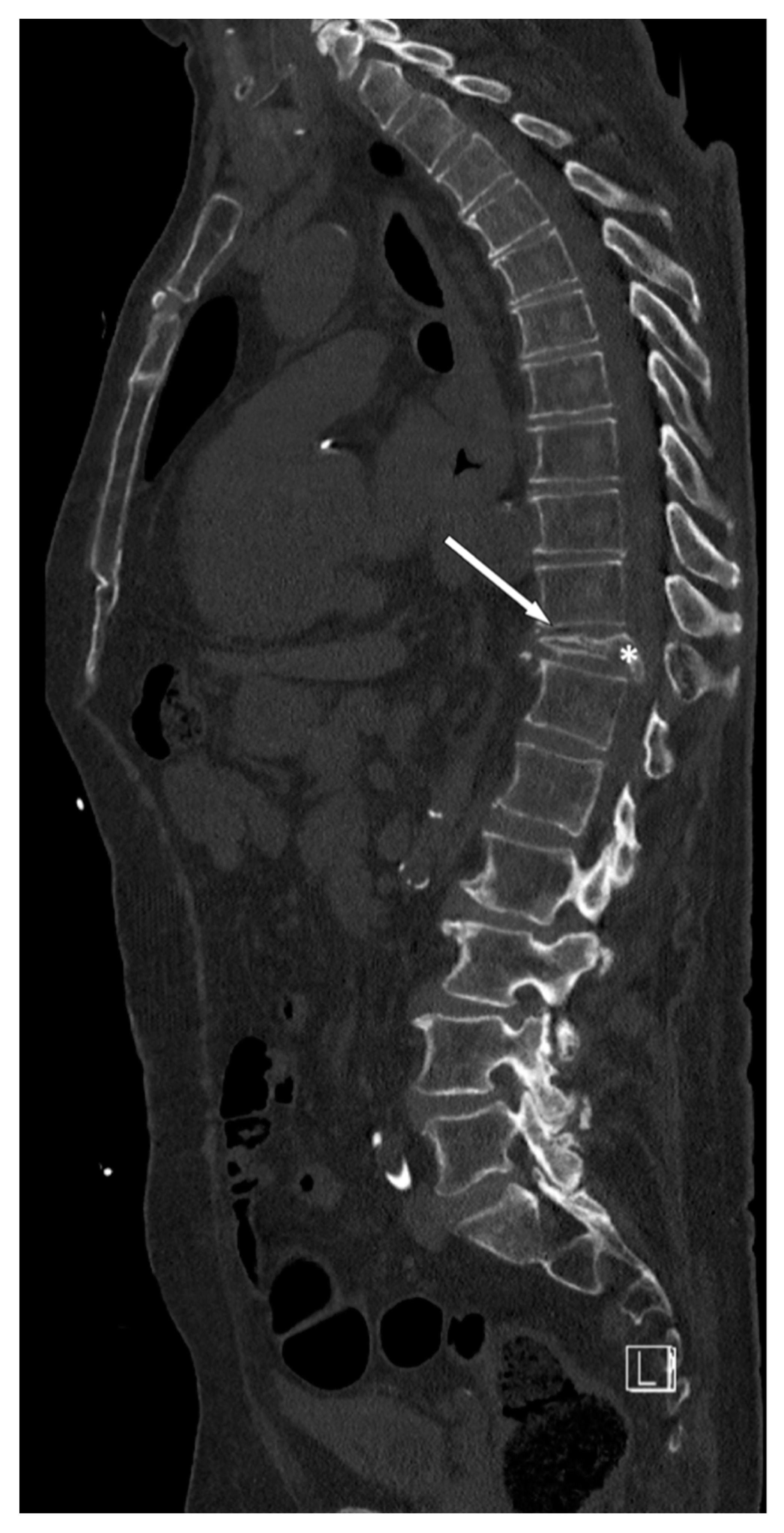 Diagnostics 13 01438 g011