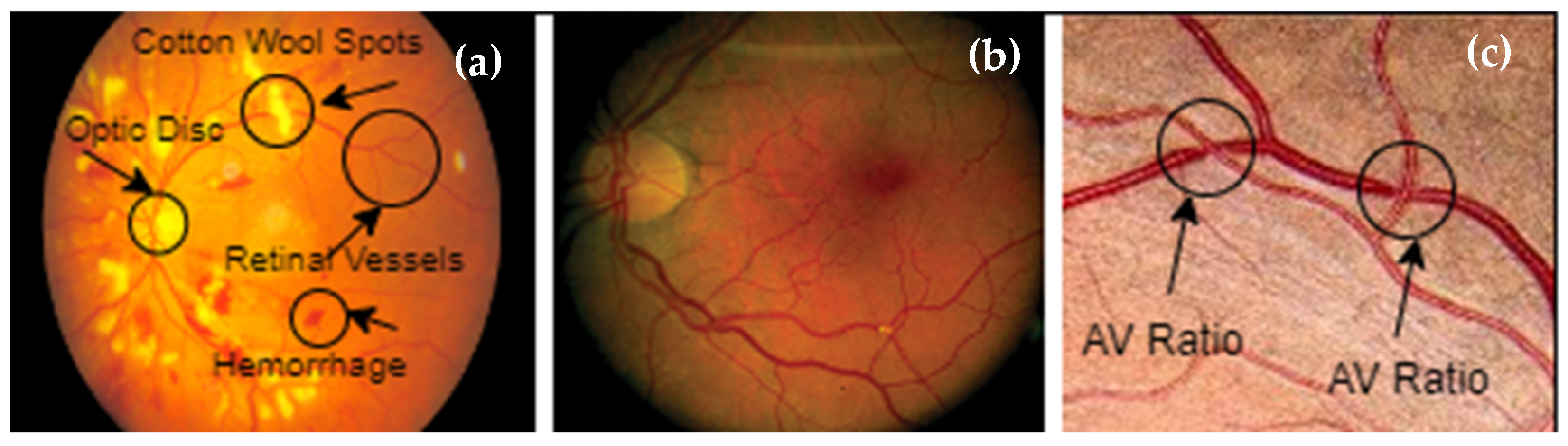 Diagnostics 13 01439 g001
