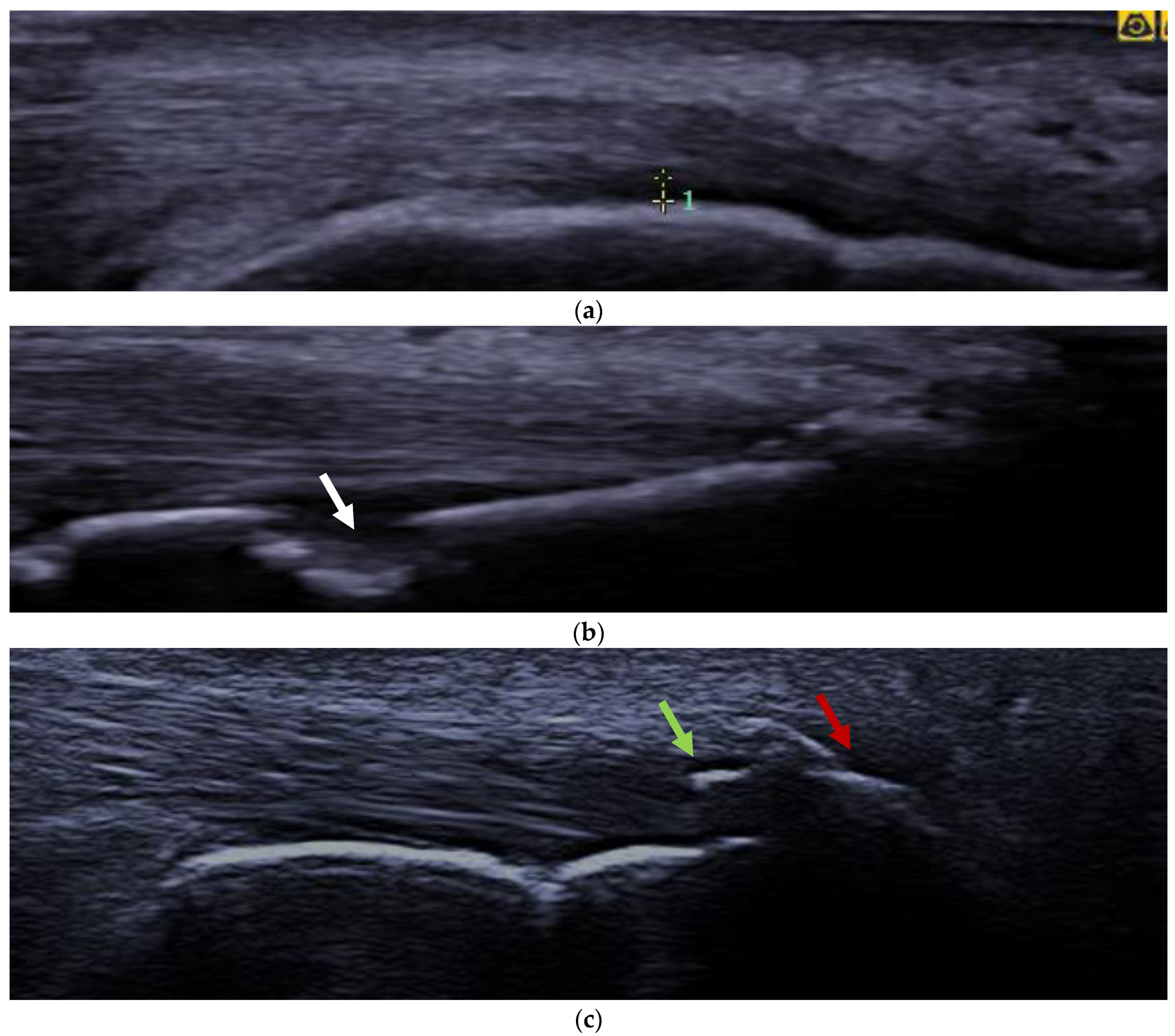Diagnostics 13 01446 g001