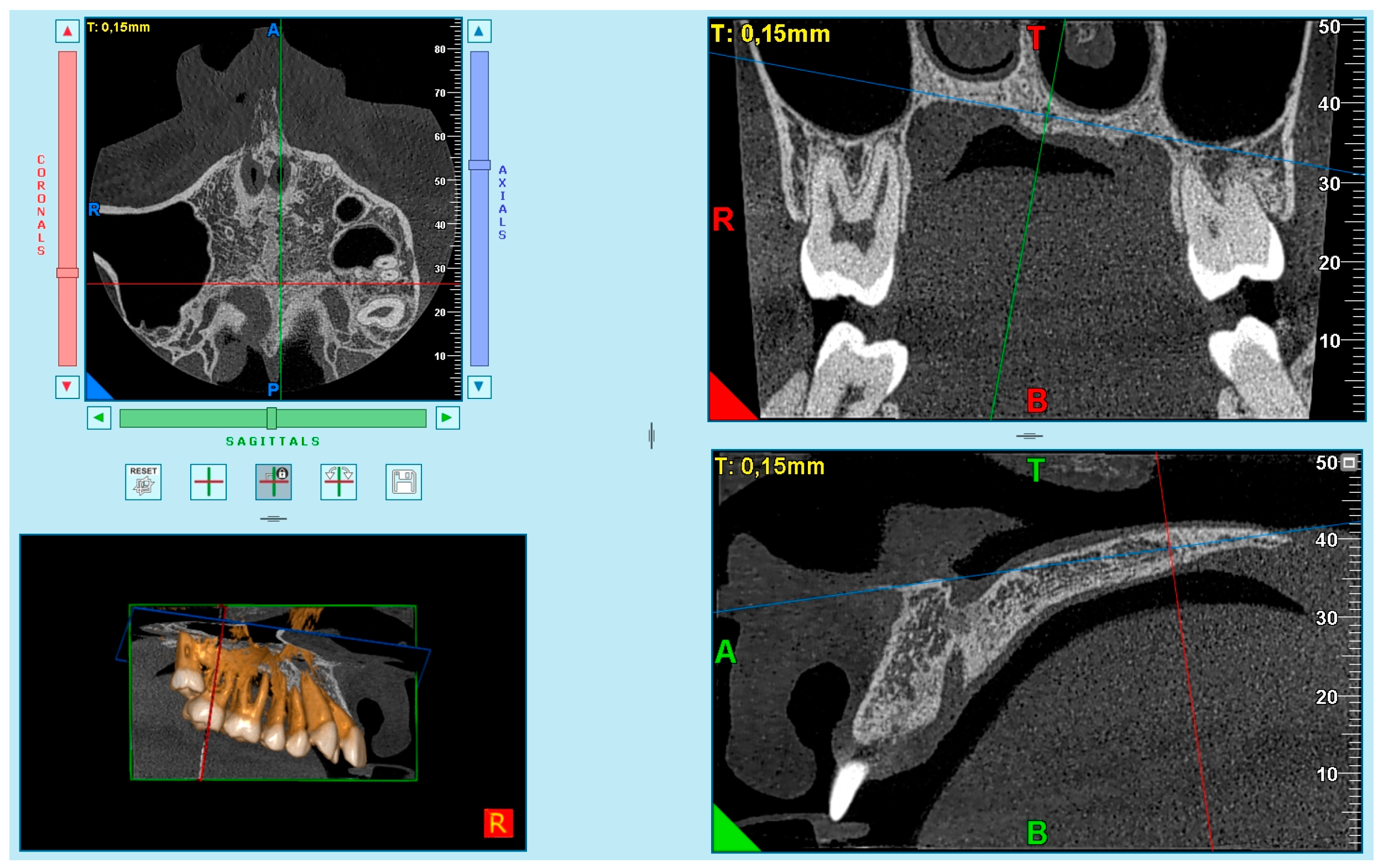 Diagnostics 13 01449 g002 Diagnostics 13 01449 g002