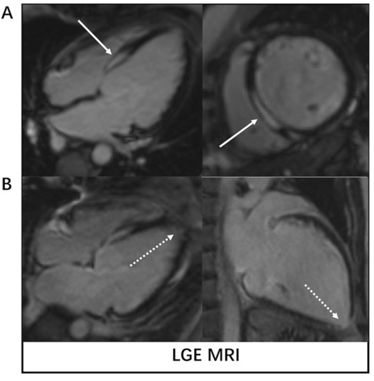 Diagnostics 13 01450 g001 550