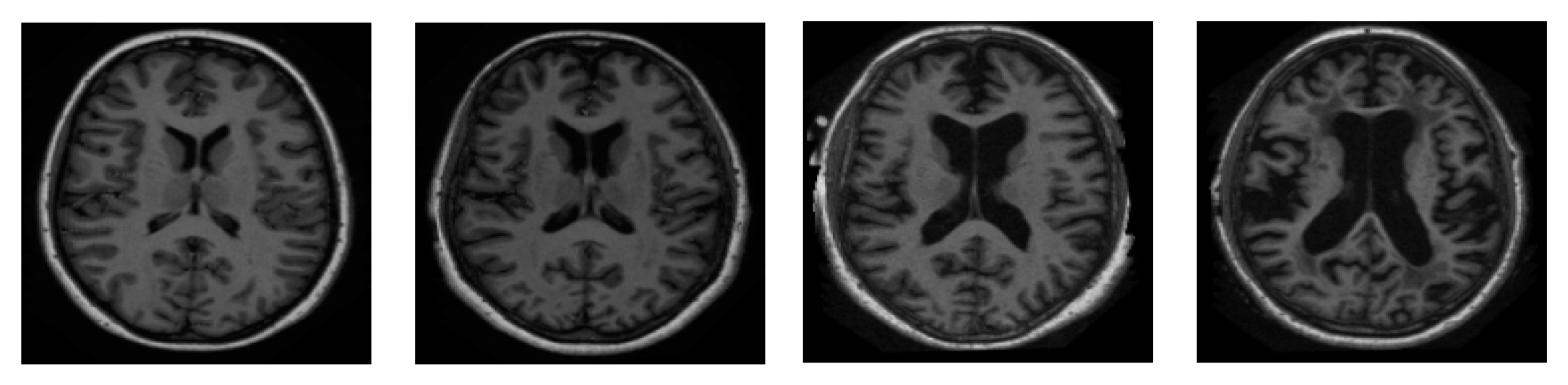 Diagnostics 13 01451 g004