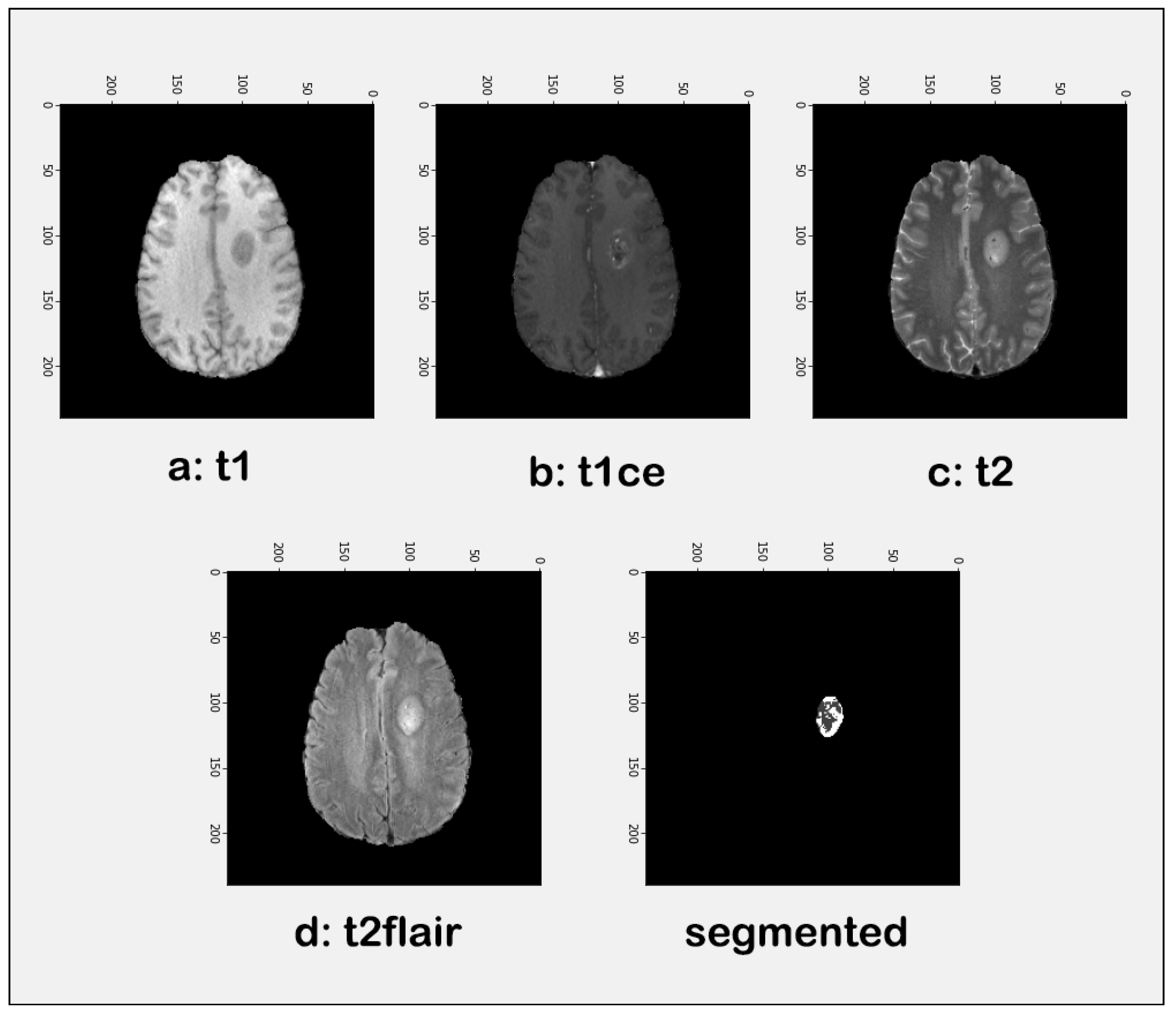Diagnostics 13 01456 g003