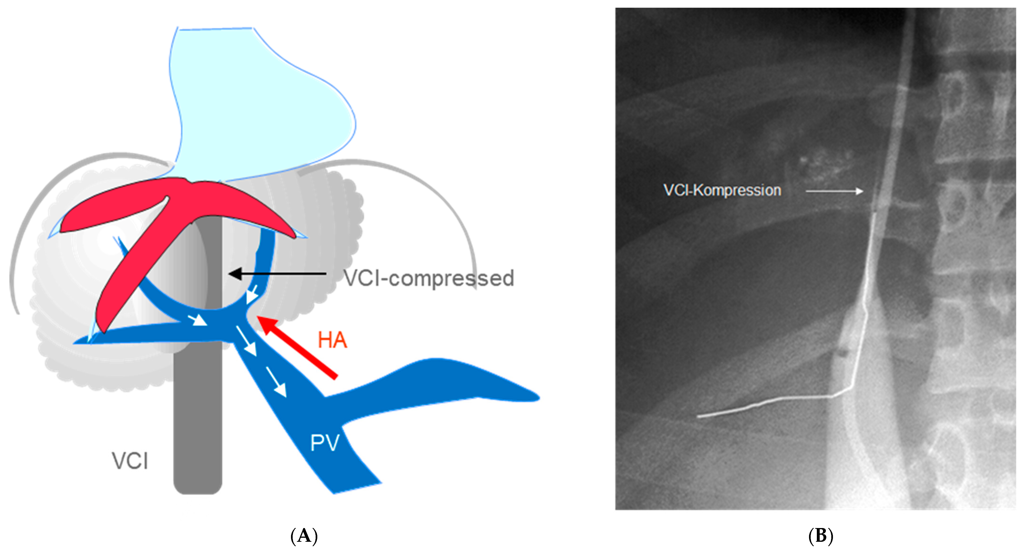Diagnostics 13 01458 g001