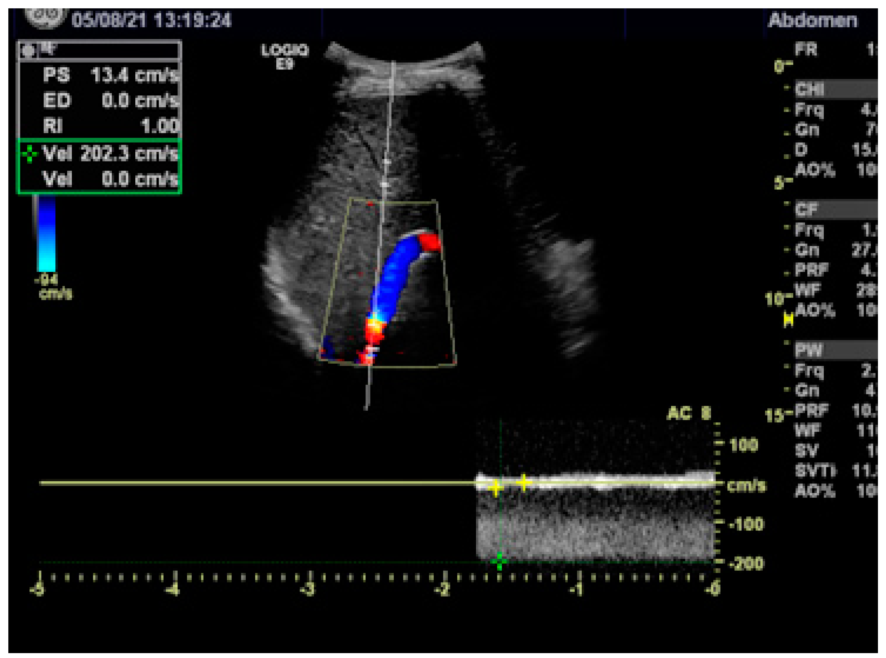 Diagnostics 13 01458 g004