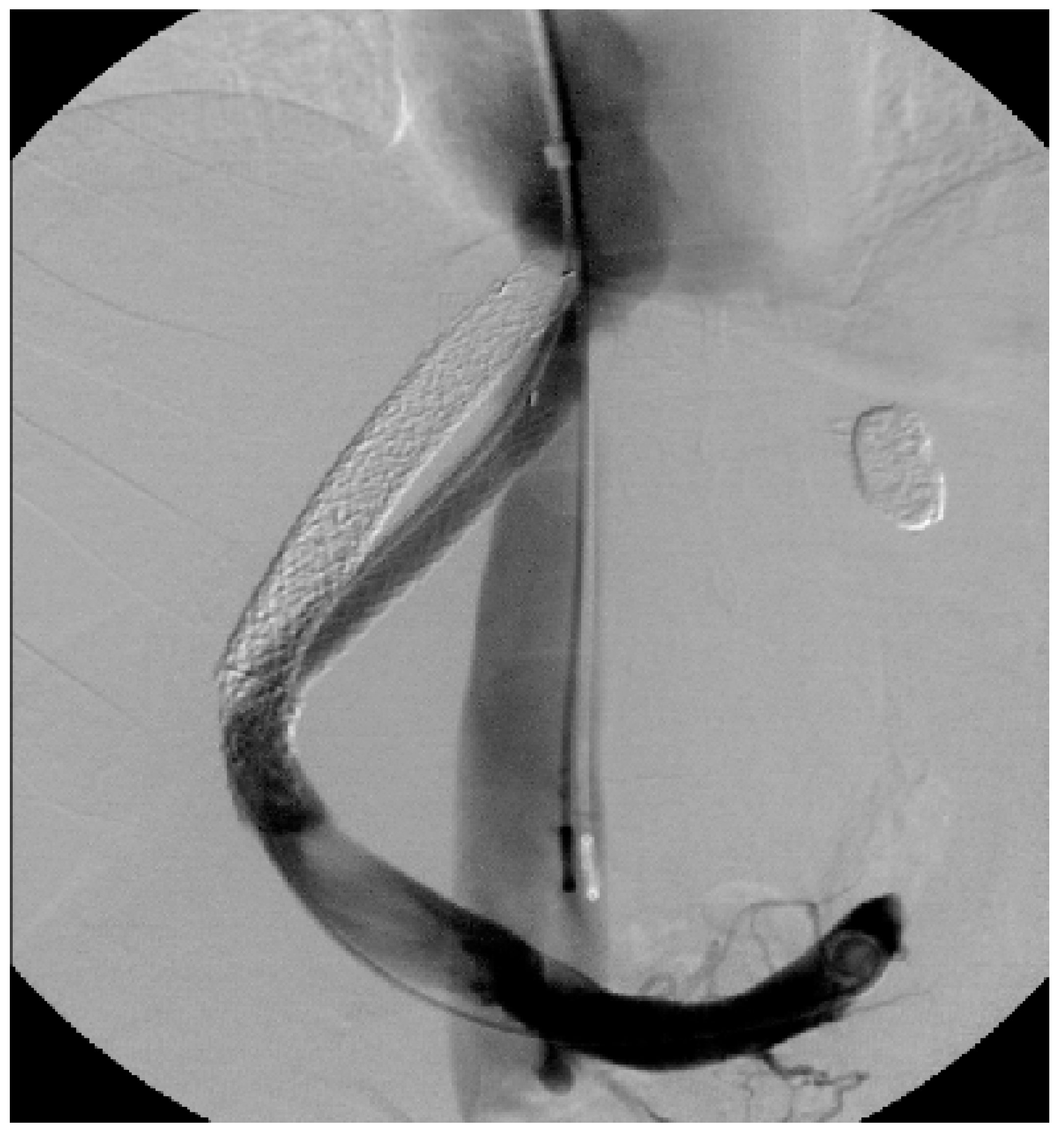 Diagnostics 13 01458 g005