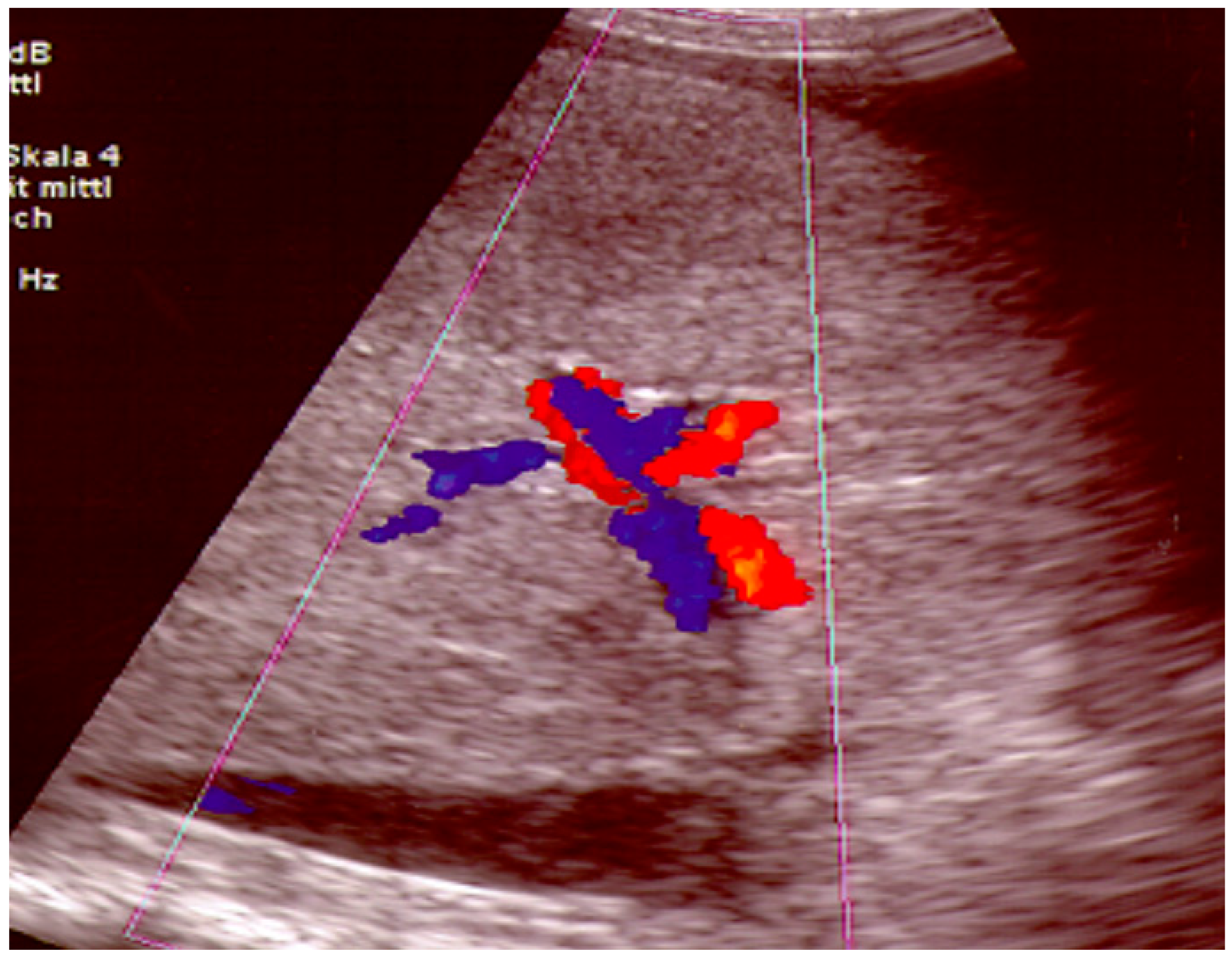 Diagnostics 13 01458 g007