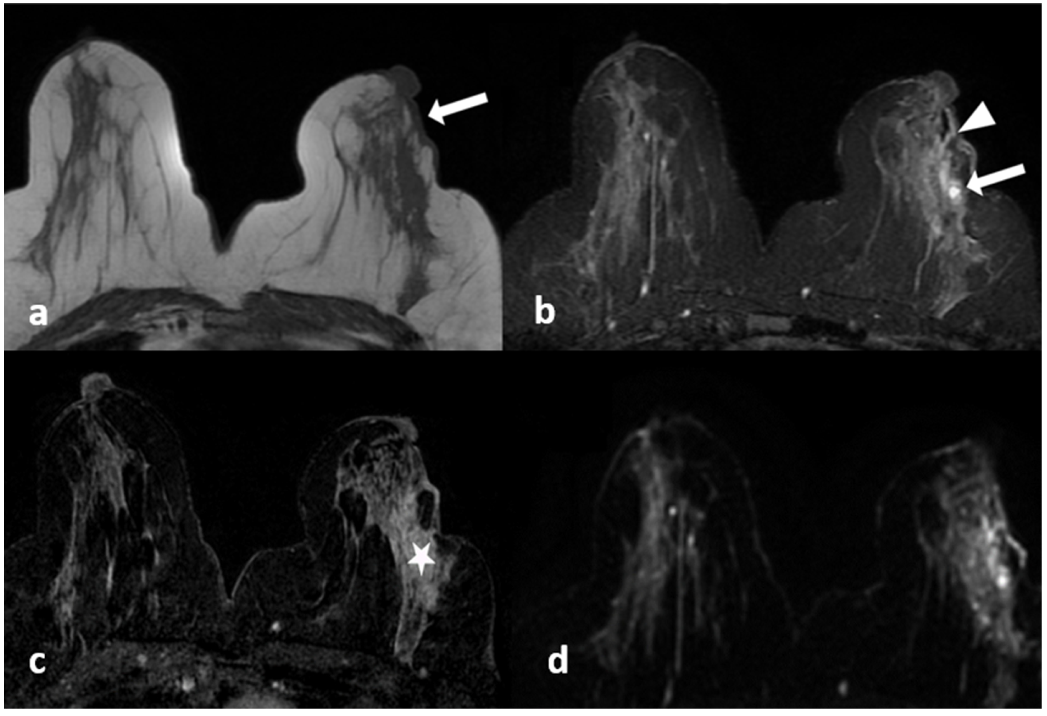 Diagnostics 13 01475 g001