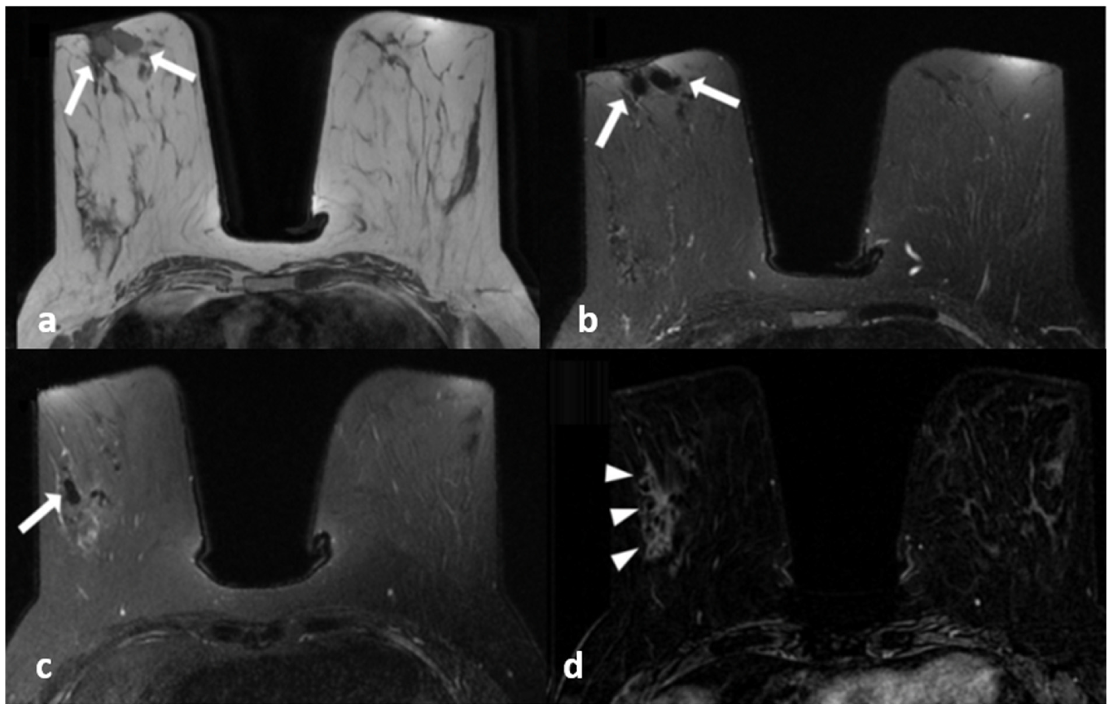 Diagnostics 13 01475 g003