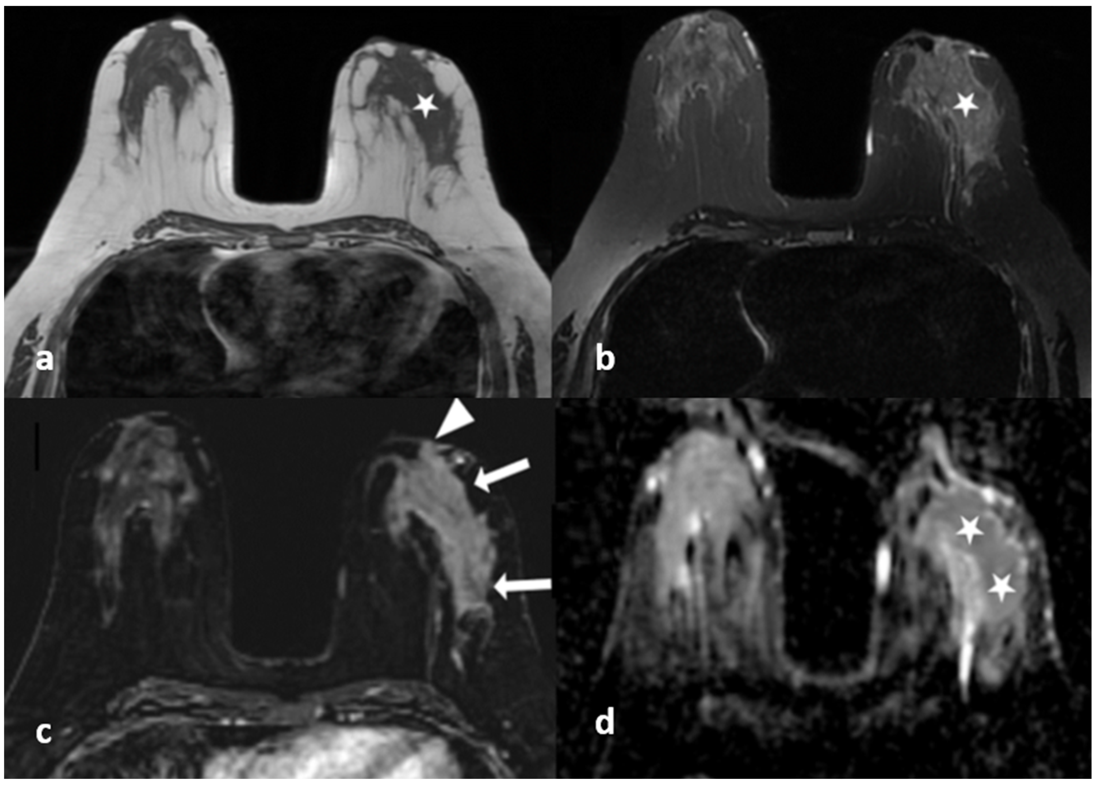 Diagnostics 13 01475 g004