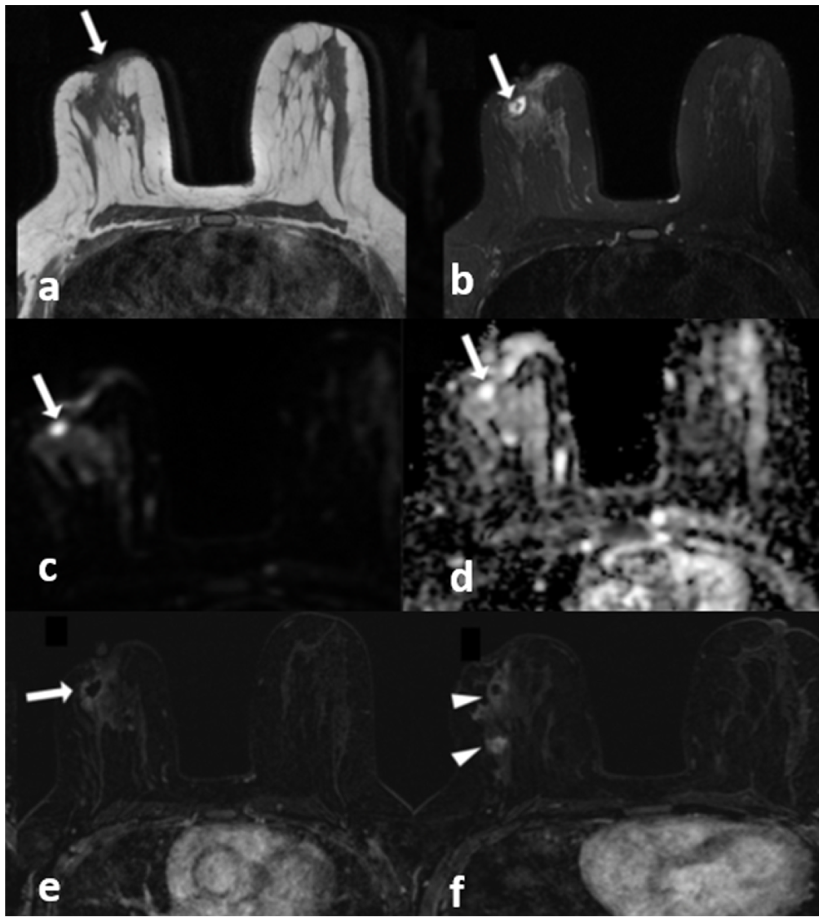 Diagnostics 13 01475 g006