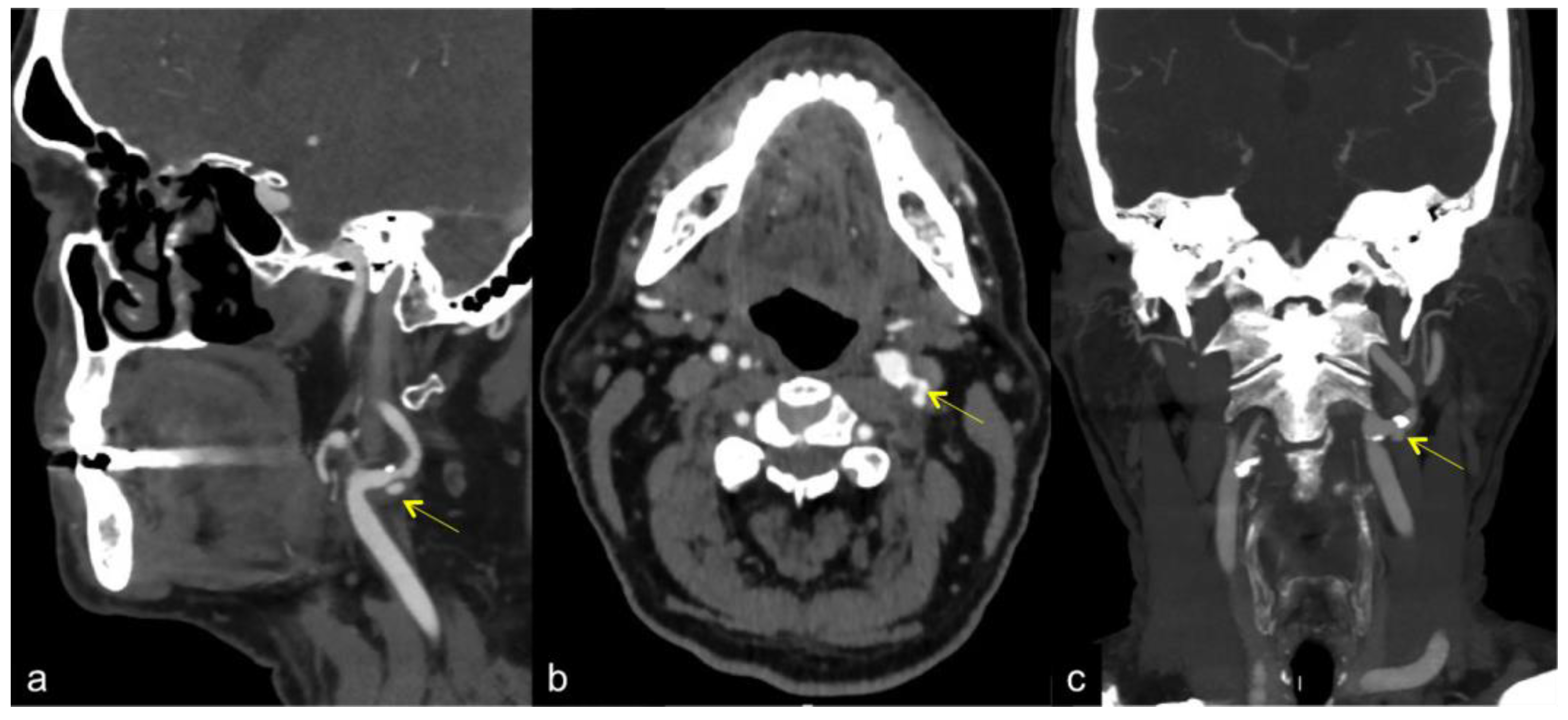 Diagnostics 13 01478 g001