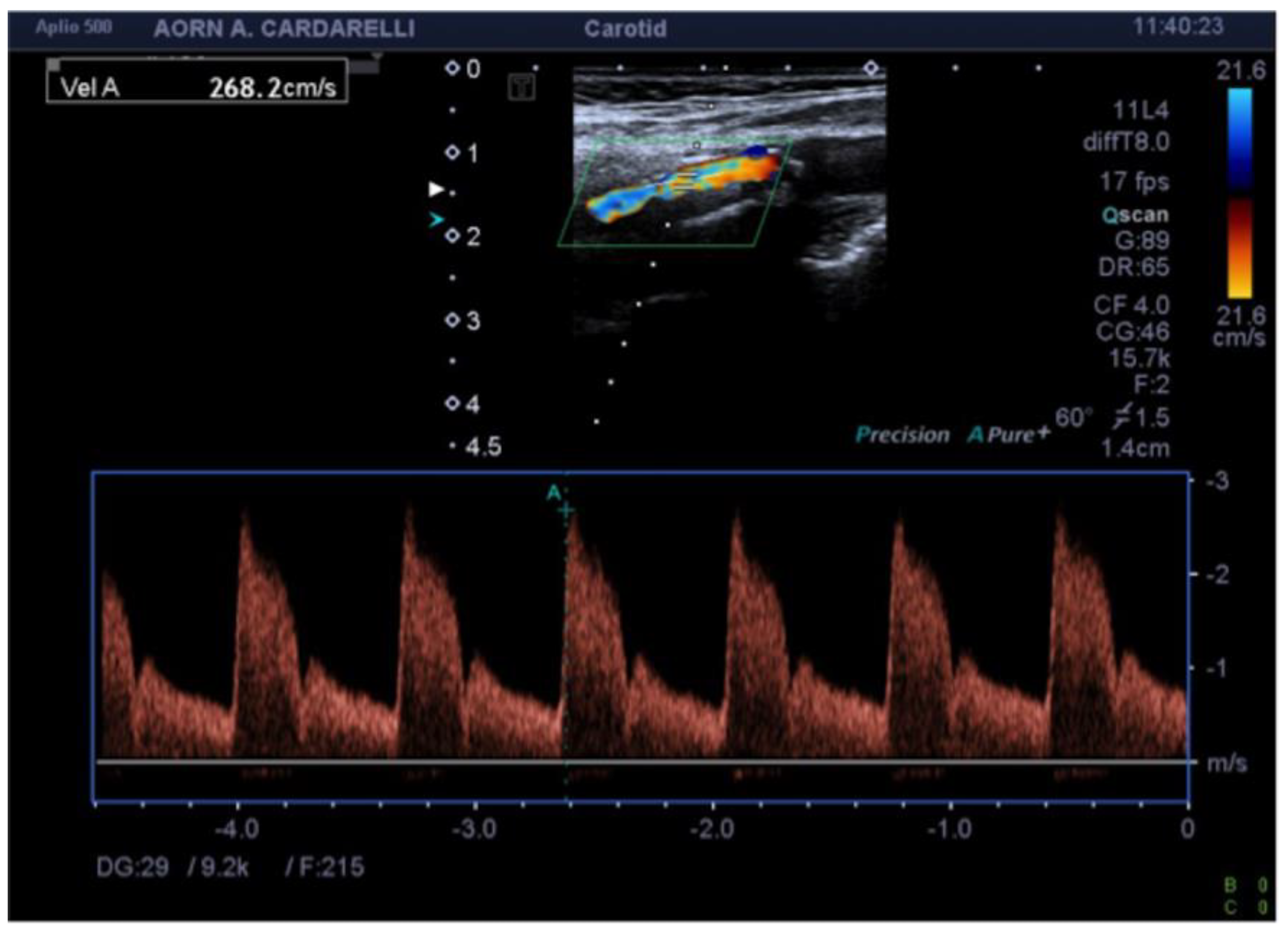 Diagnostics 13 01478 g003