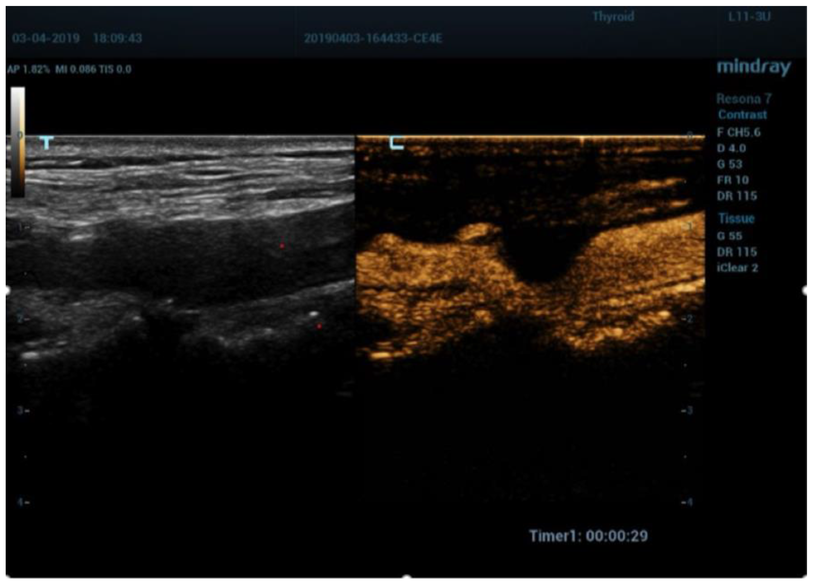 Diagnostics 13 01478 g005